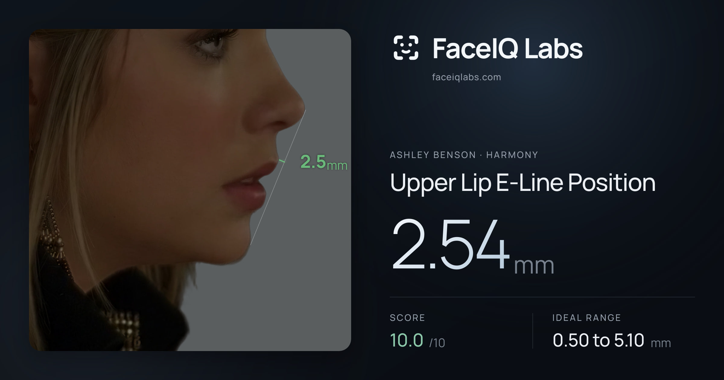 Ashley Benson Upper Lip E-Line Position: 2.54mm, drawn on the photo