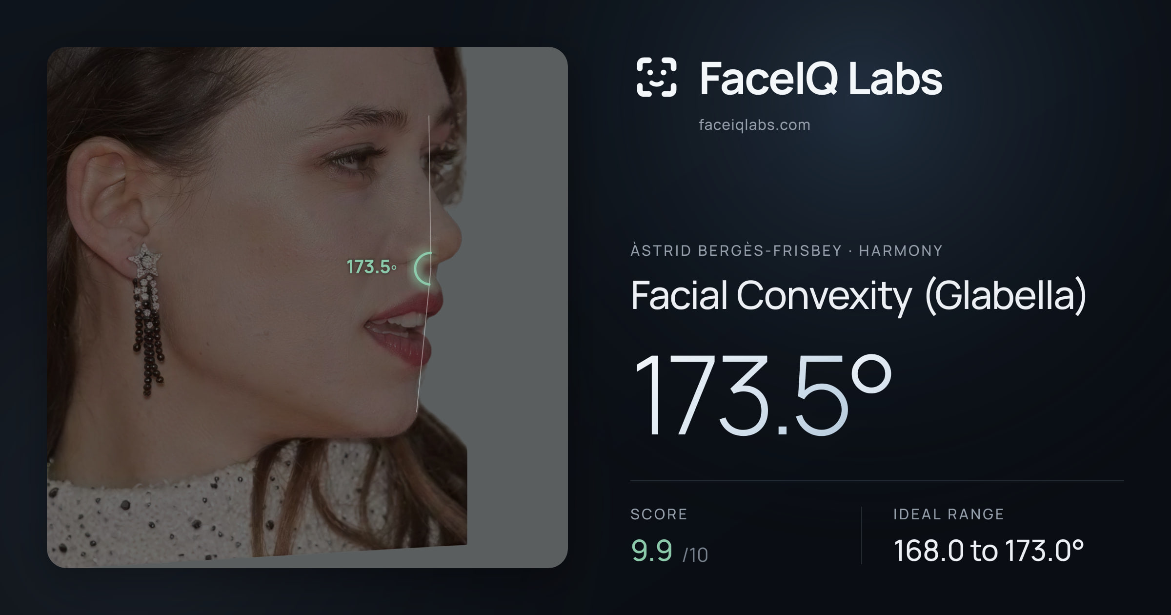 Àstrid Bergès-Frisbey Facial Convexity (Glabella): 173.5°, drawn on the photo