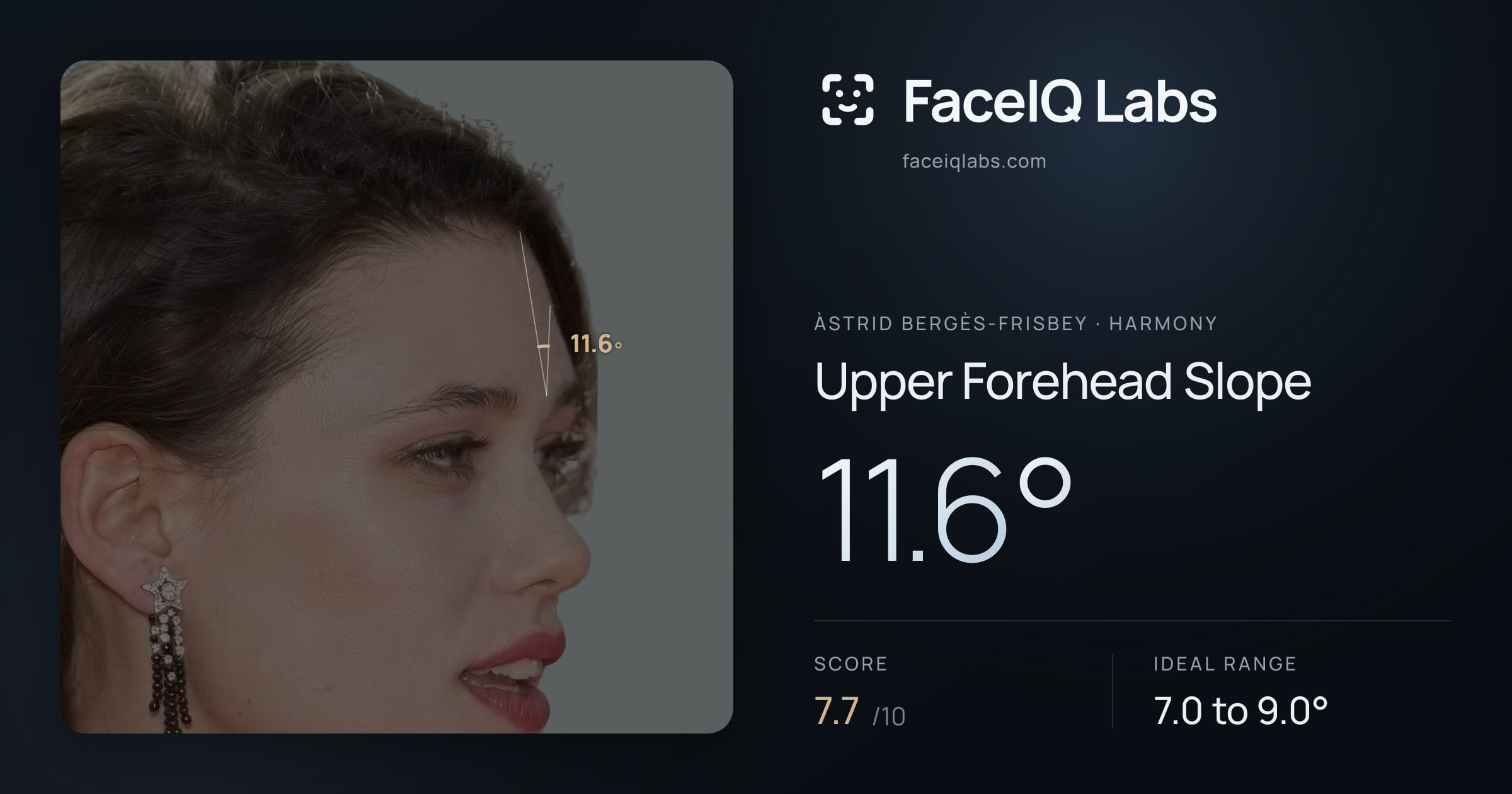 Àstrid Bergès-Frisbey Upper Forehead Slope: 11.6°, drawn on the photo