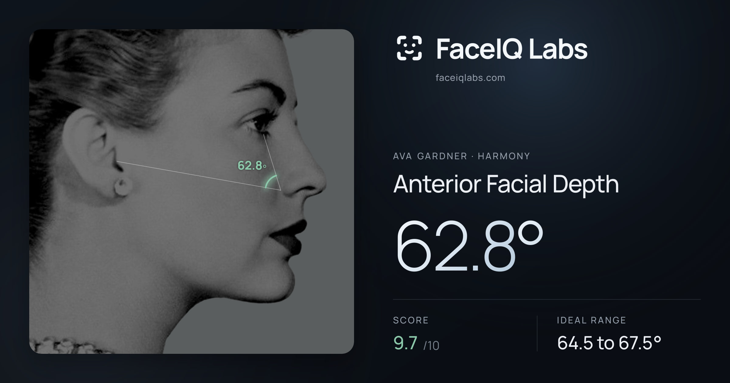 Ava Gardner Anterior Facial Depth: 62.8°, drawn on the photo