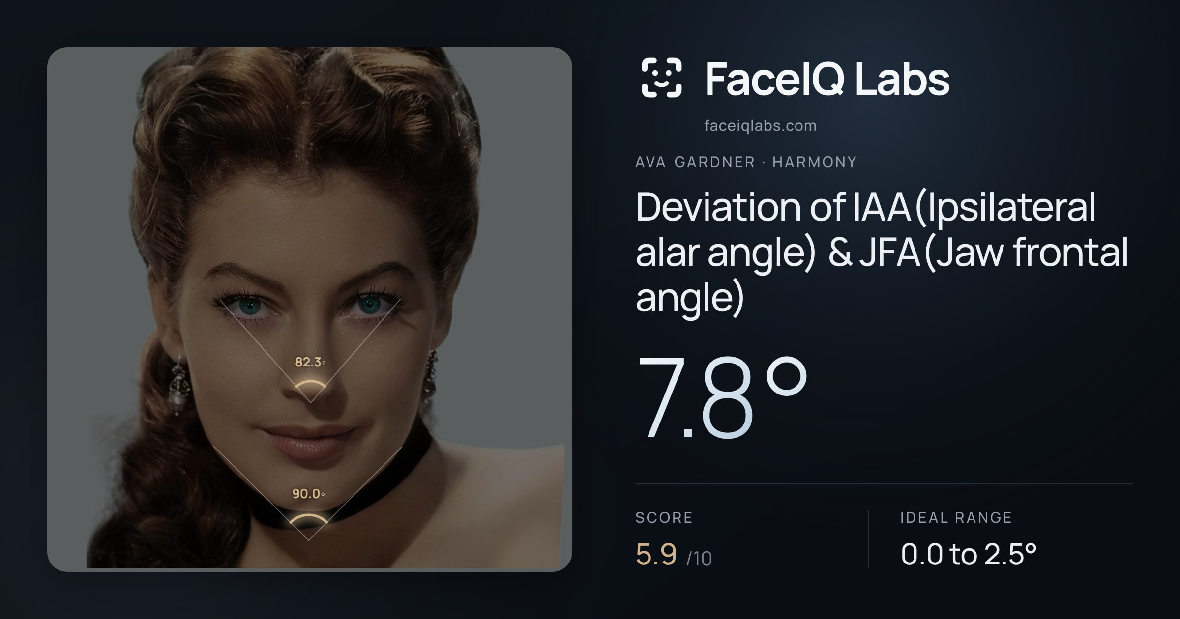 Ava Gardner Deviation of IAA(Ipsilateral alar angle) & JFA(Jaw frontal angle): 7.8°, drawn on the photo