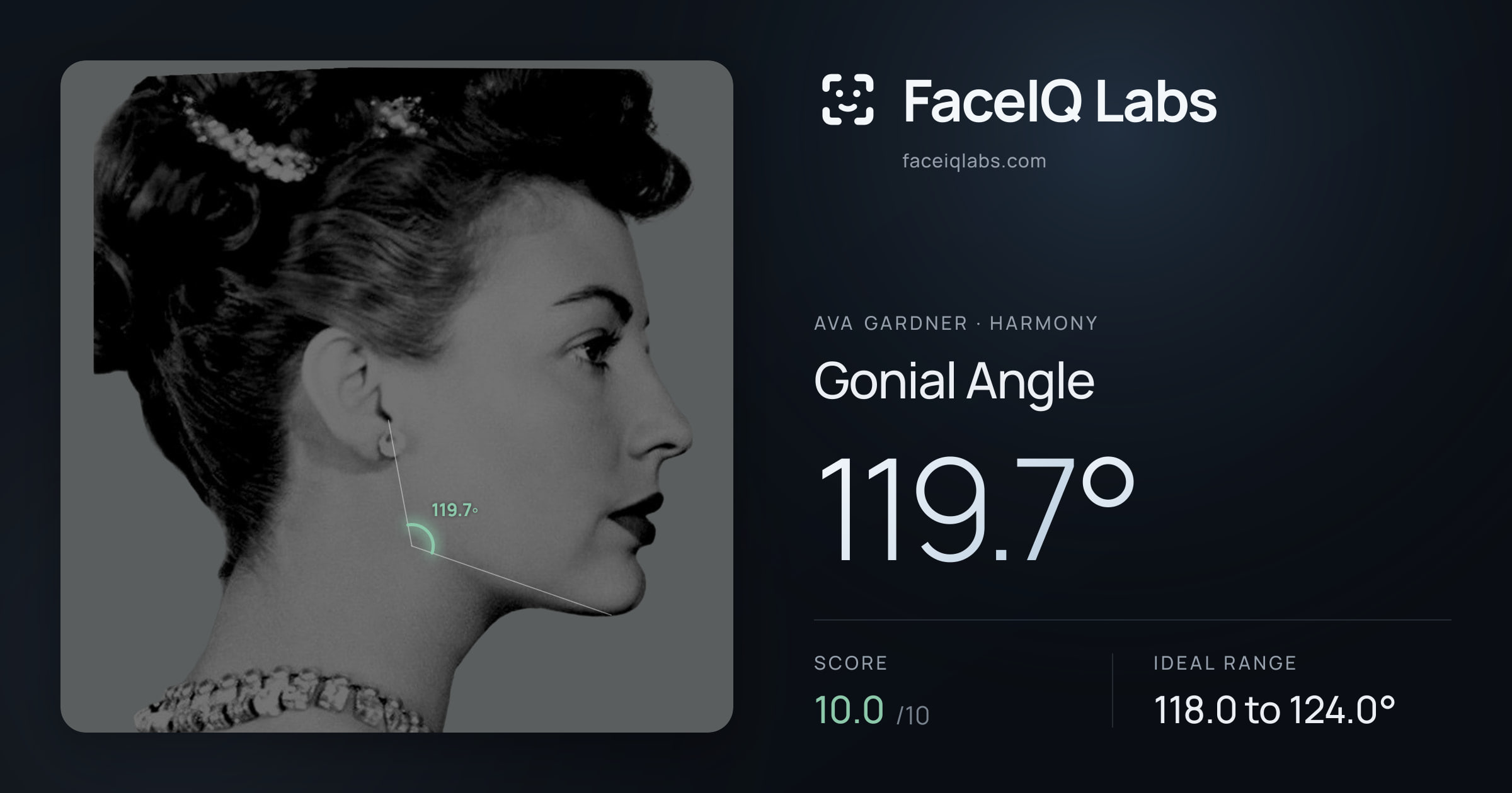 Ava Gardner Gonial Angle: 119.7°, drawn on the photo