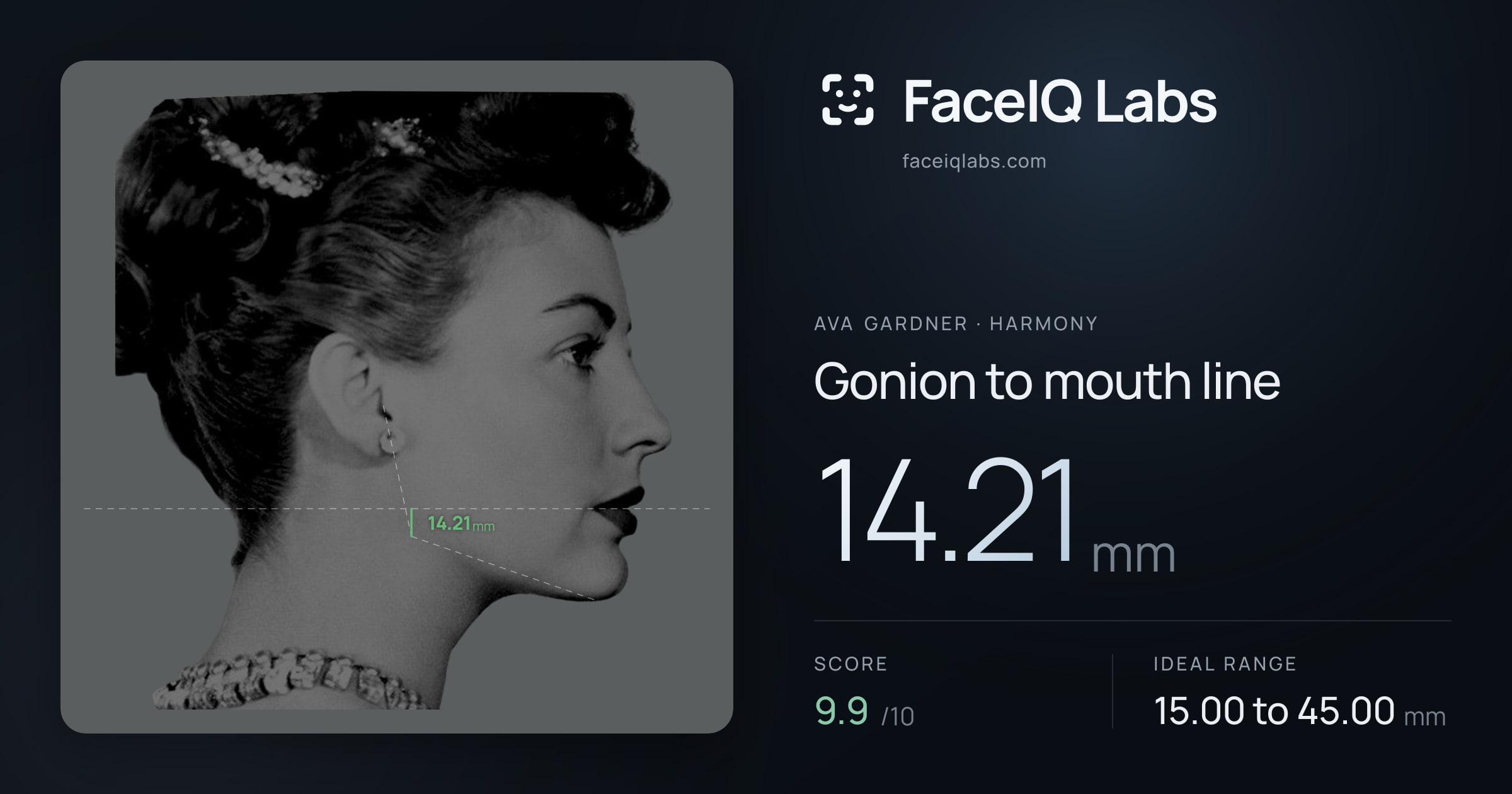 Ava Gardner Gonion to mouth line: 14.21mm, drawn on the photo