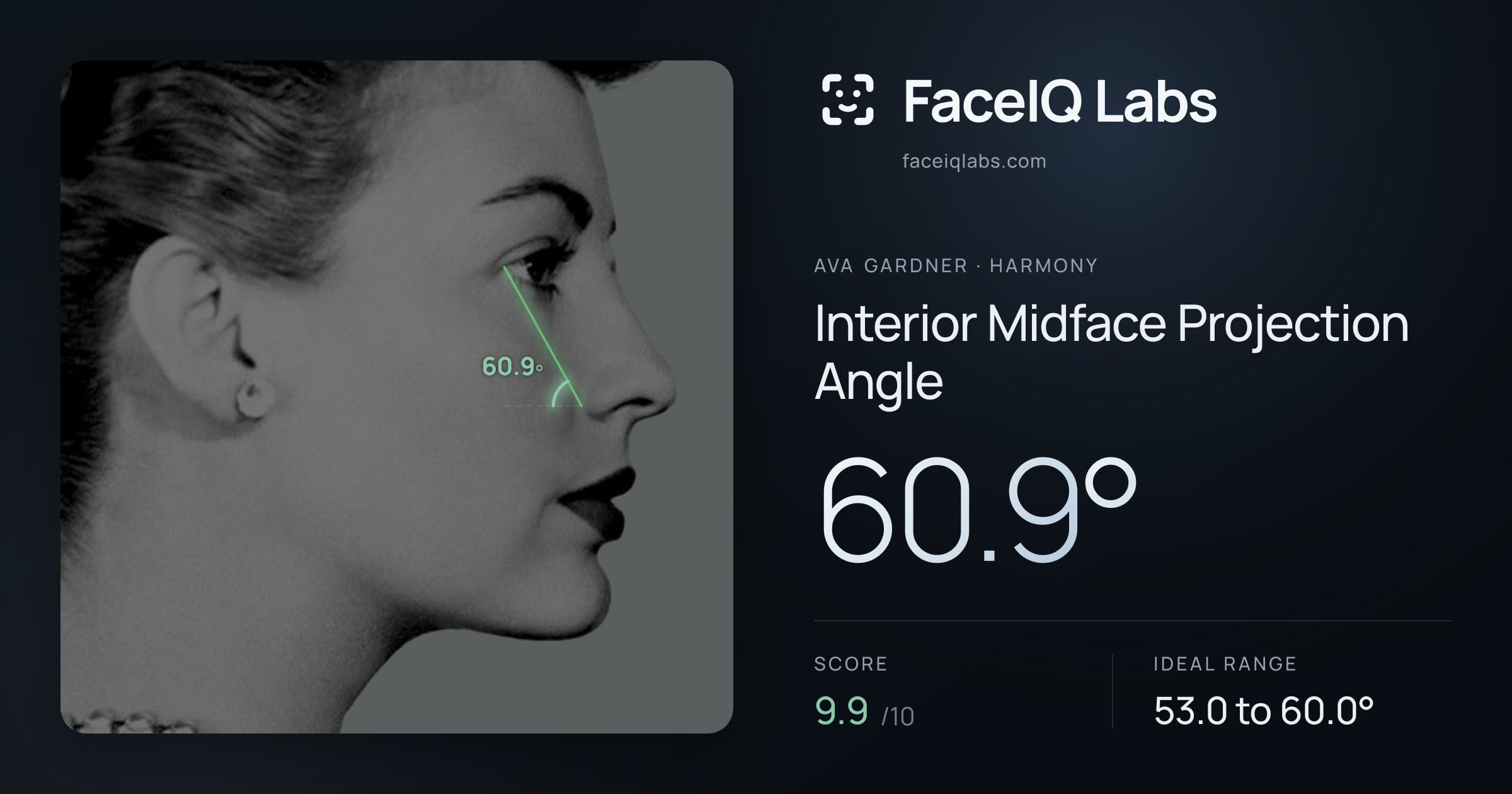 Ava Gardner Interior Midface Projection Angle: 60.9°, drawn on the photo