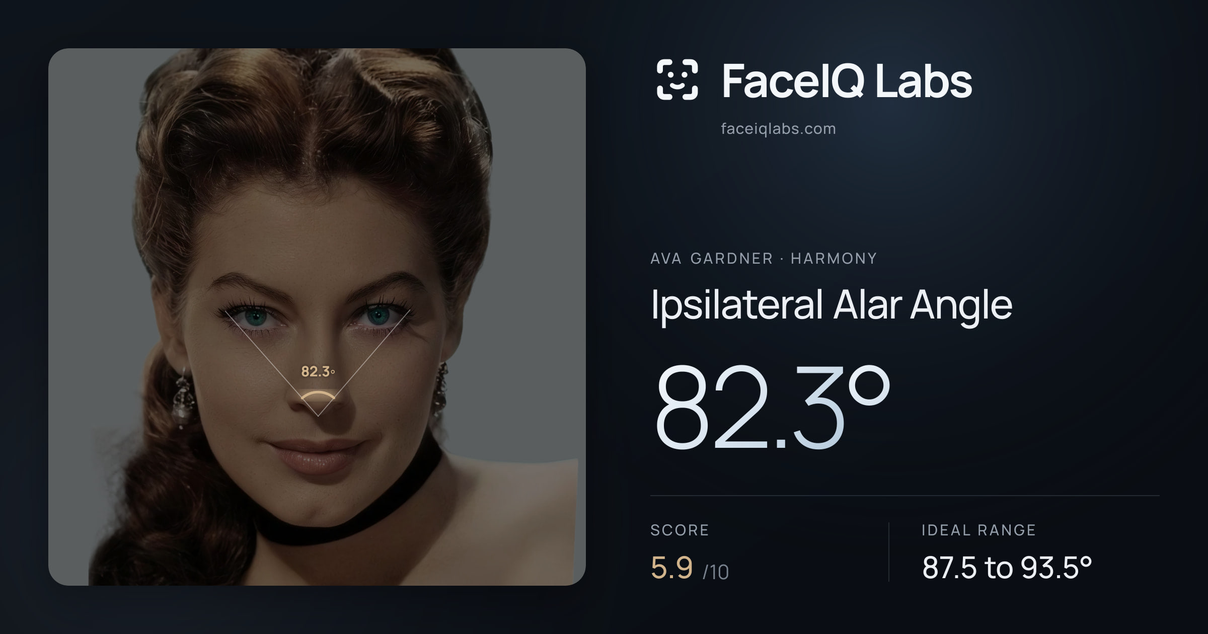 Ava Gardner Ipsilateral Alar Angle: 82.3°, drawn on the photo