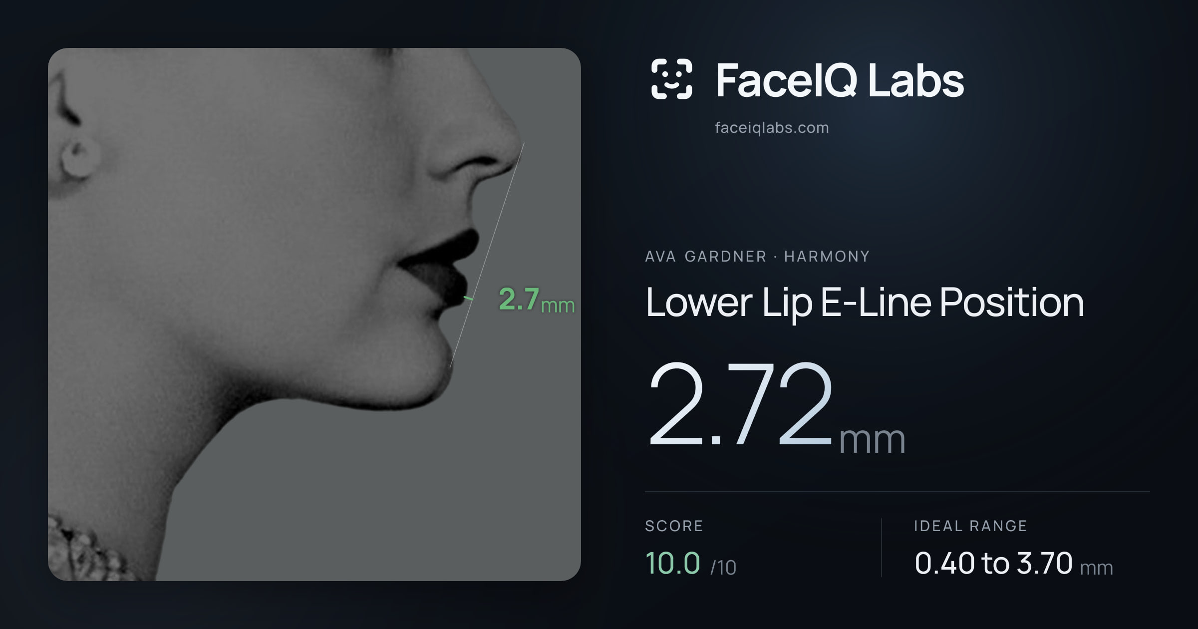 Ava Gardner Lower Lip E-Line Position: 2.72mm, drawn on the photo