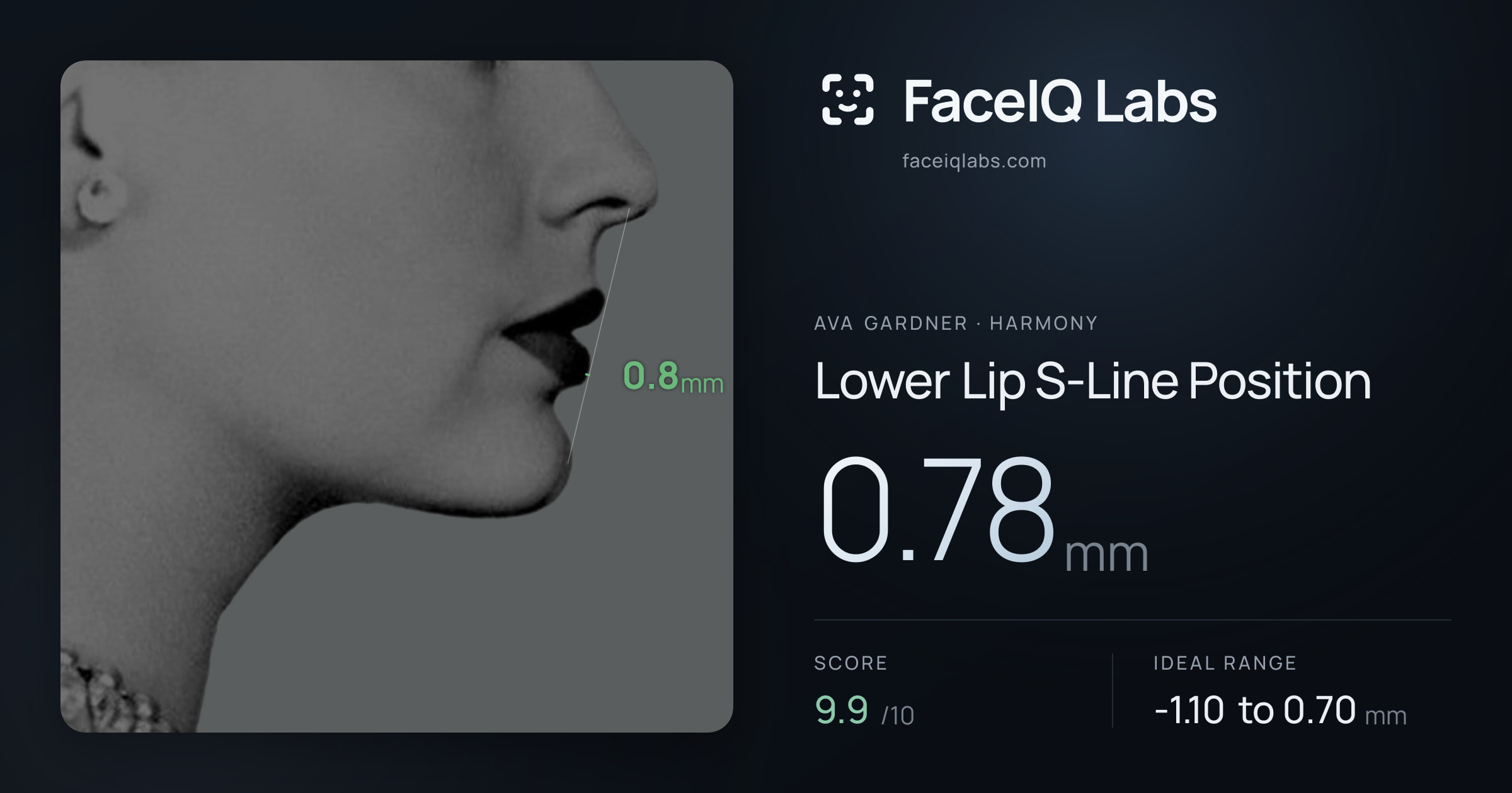 Ava Gardner Lower Lip S-Line Position: 0.78mm, drawn on the photo