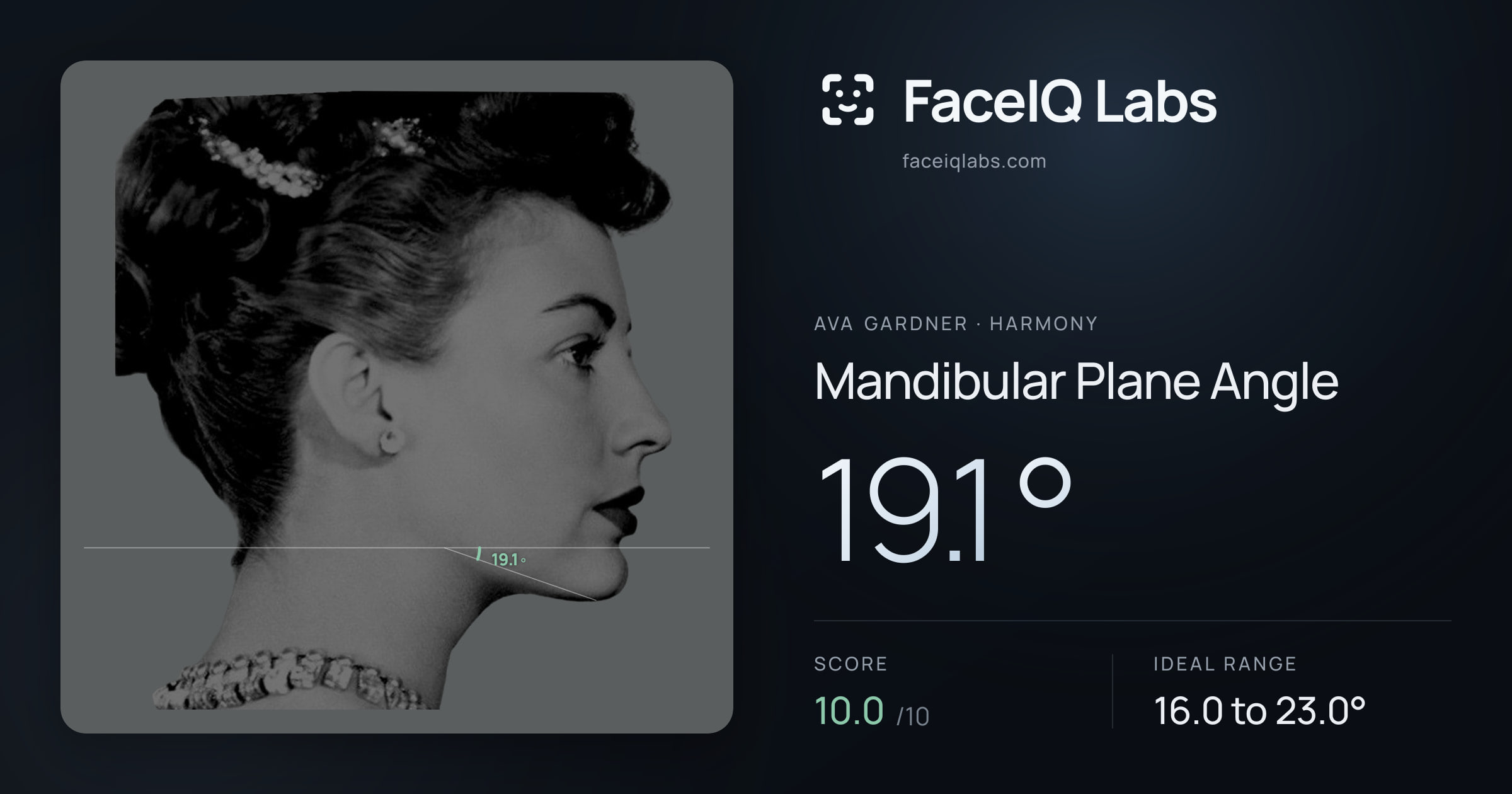 Ava Gardner Mandibular Plane Angle: 19.1°, drawn on the photo