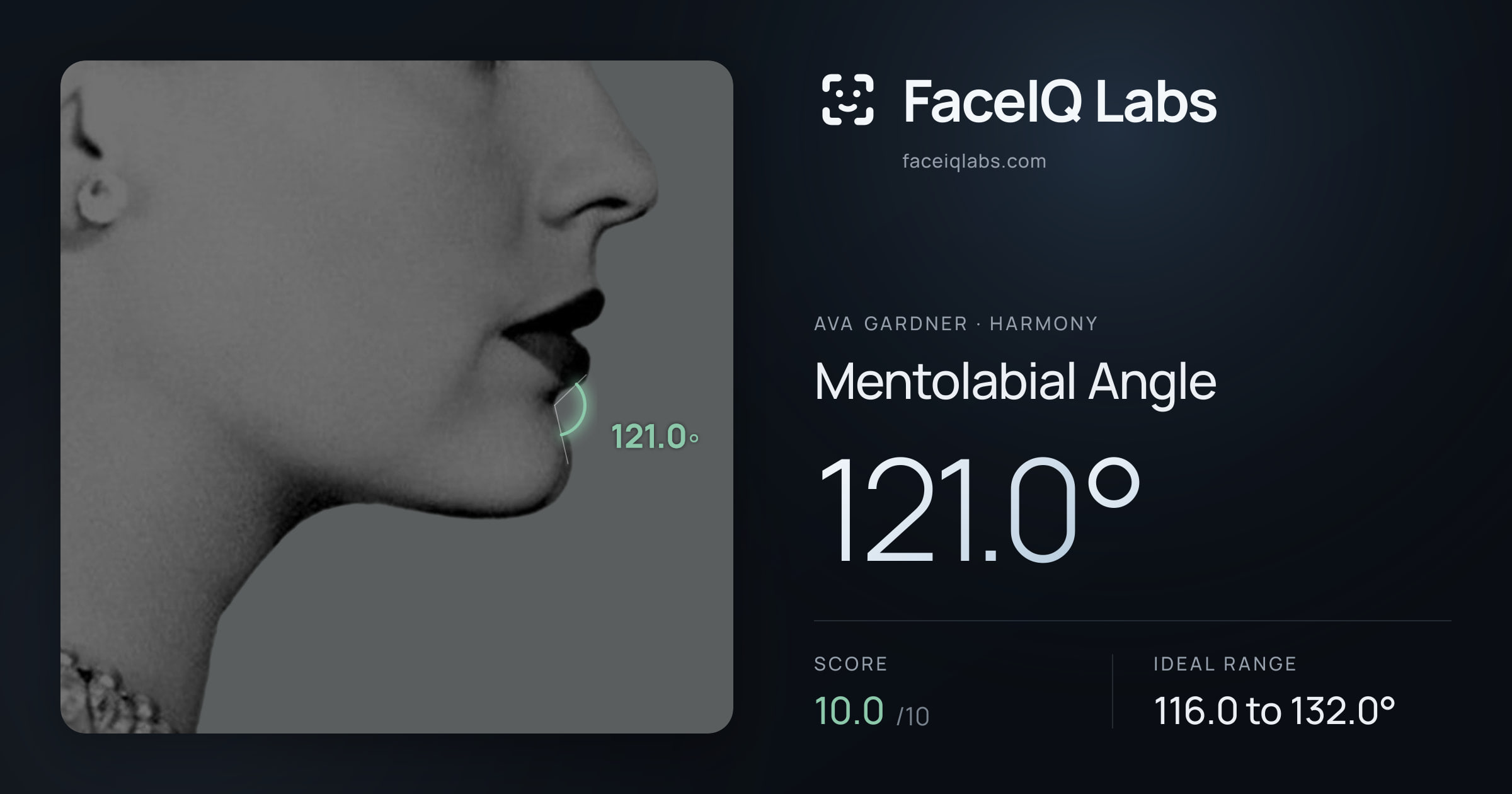 Ava Gardner Mentolabial Angle: 121.0°, drawn on the photo