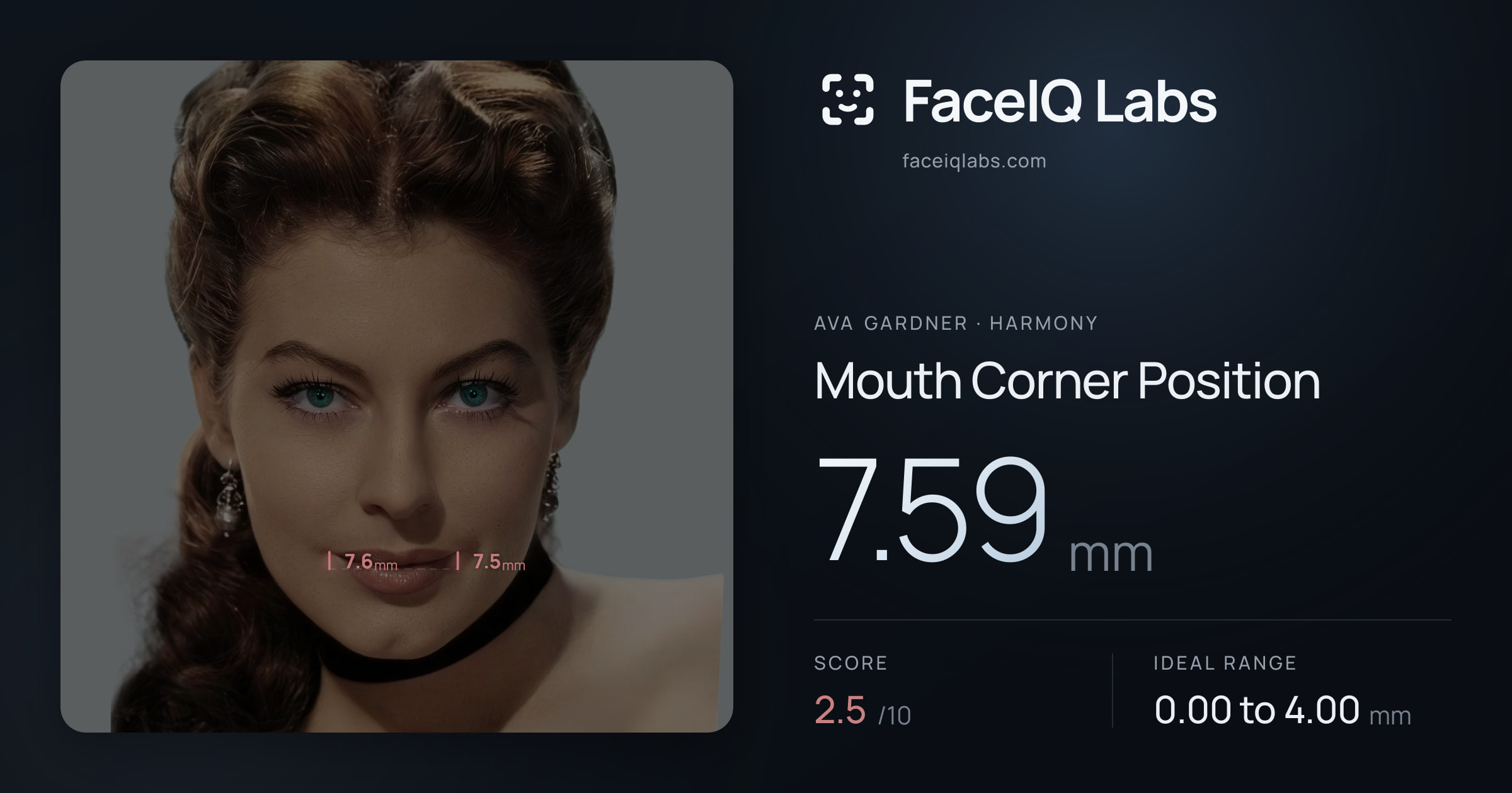 Ava Gardner Mouth Corner Position: 7.59mm, drawn on the photo