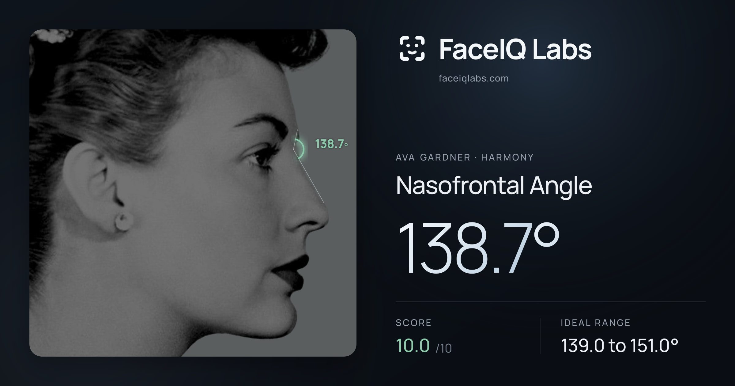 Ava Gardner Nasofrontal Angle: 138.7°, drawn on the photo