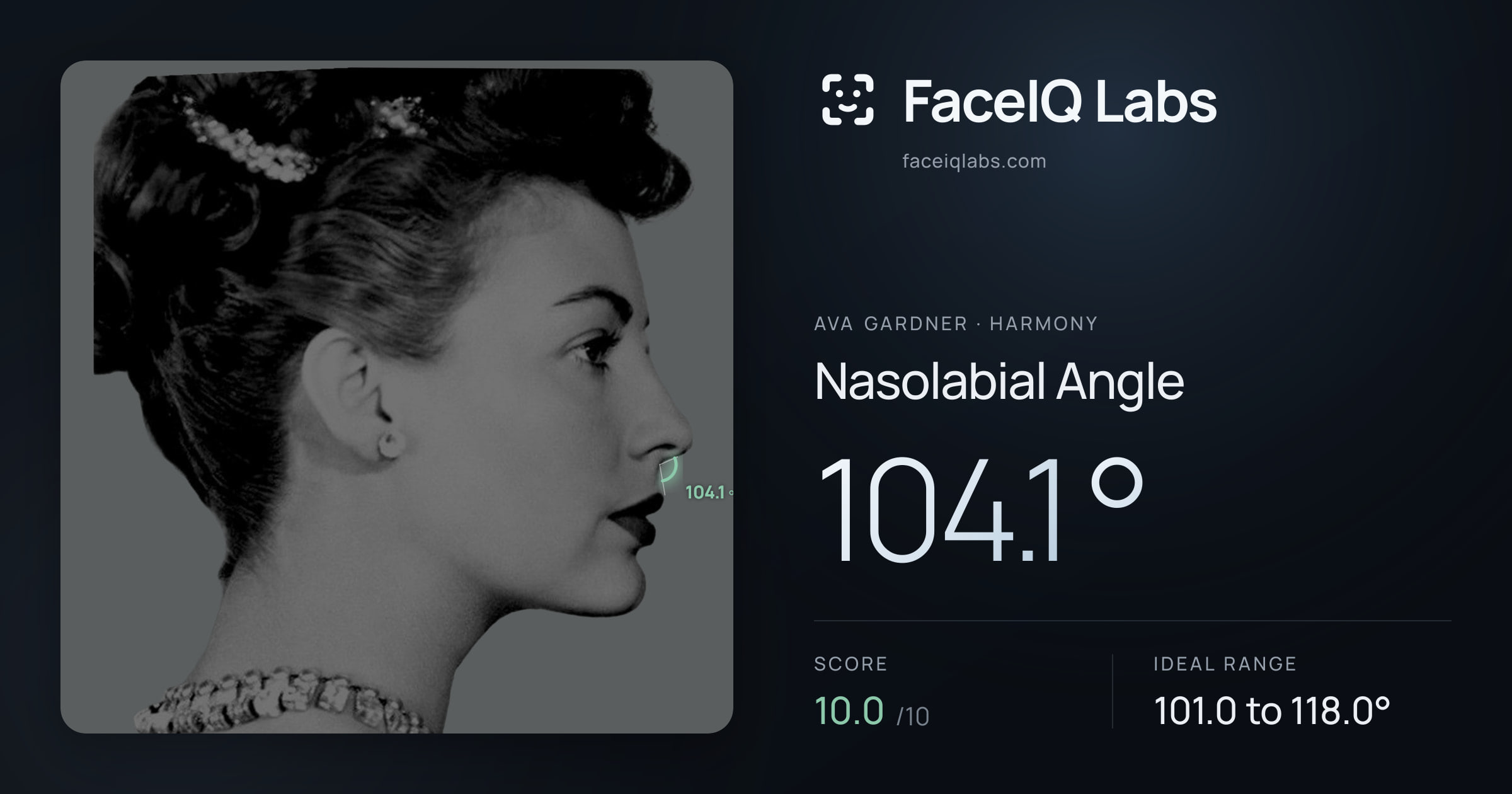Ava Gardner Nasolabial Angle: 104.1°, drawn on the photo