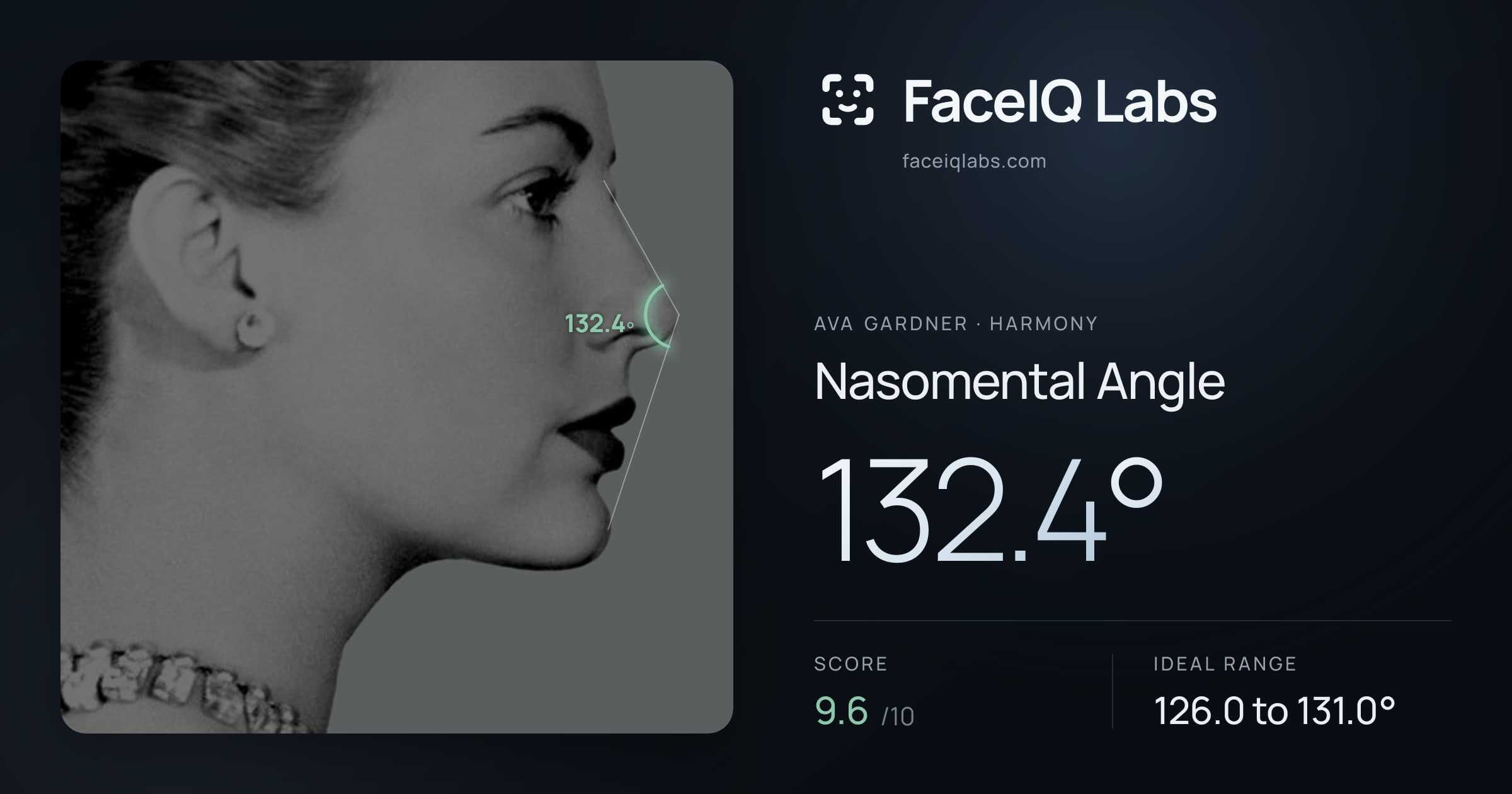 Ava Gardner Nasomental Angle: 132.4°, drawn on the photo