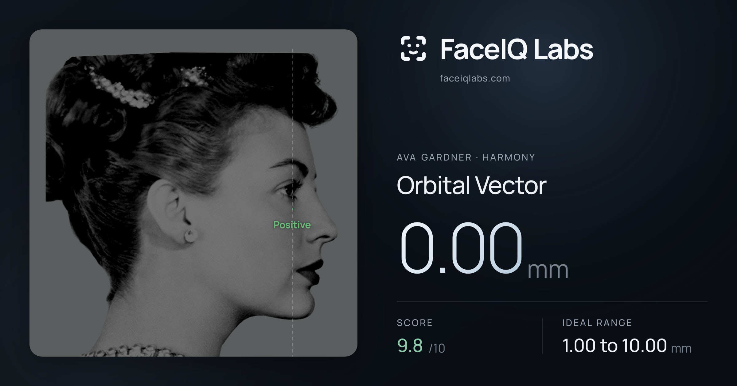 Ava Gardner Orbital Vector: 0.00mm, drawn on the photo