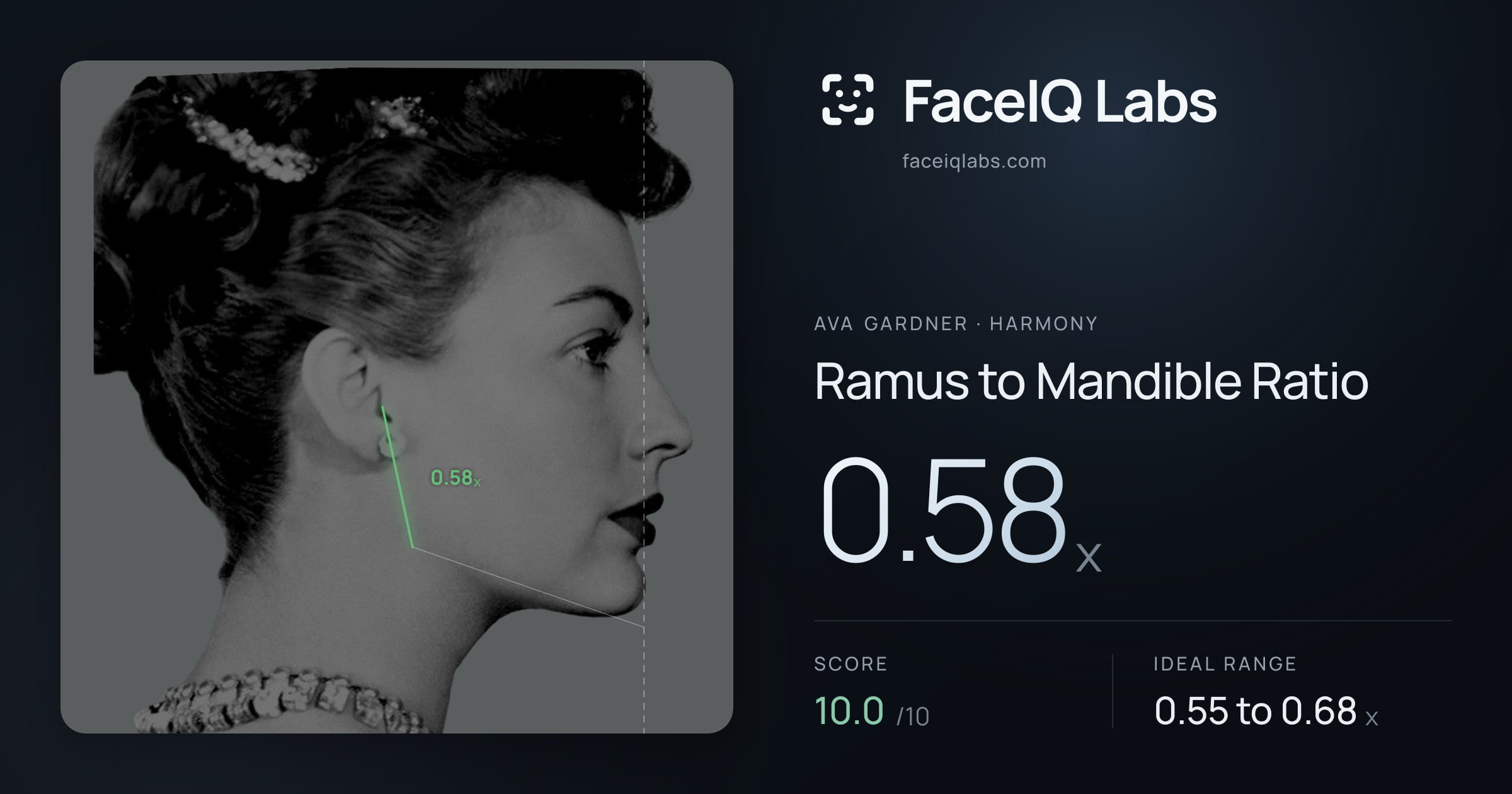 Ava Gardner Ramus to Mandible Ratio: 0.58x, drawn on the photo