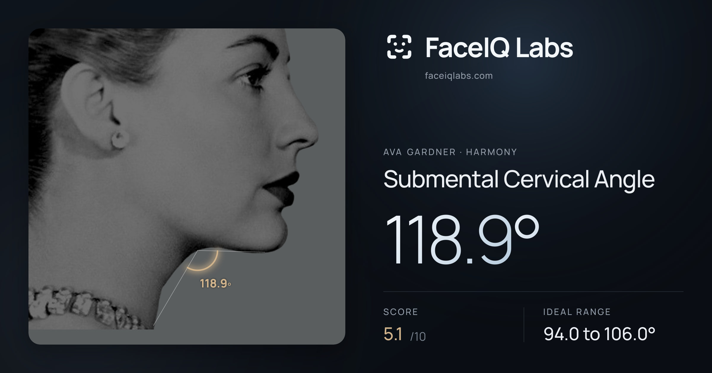 Ava Gardner Submental Cervical Angle: 118.9°, drawn on the photo
