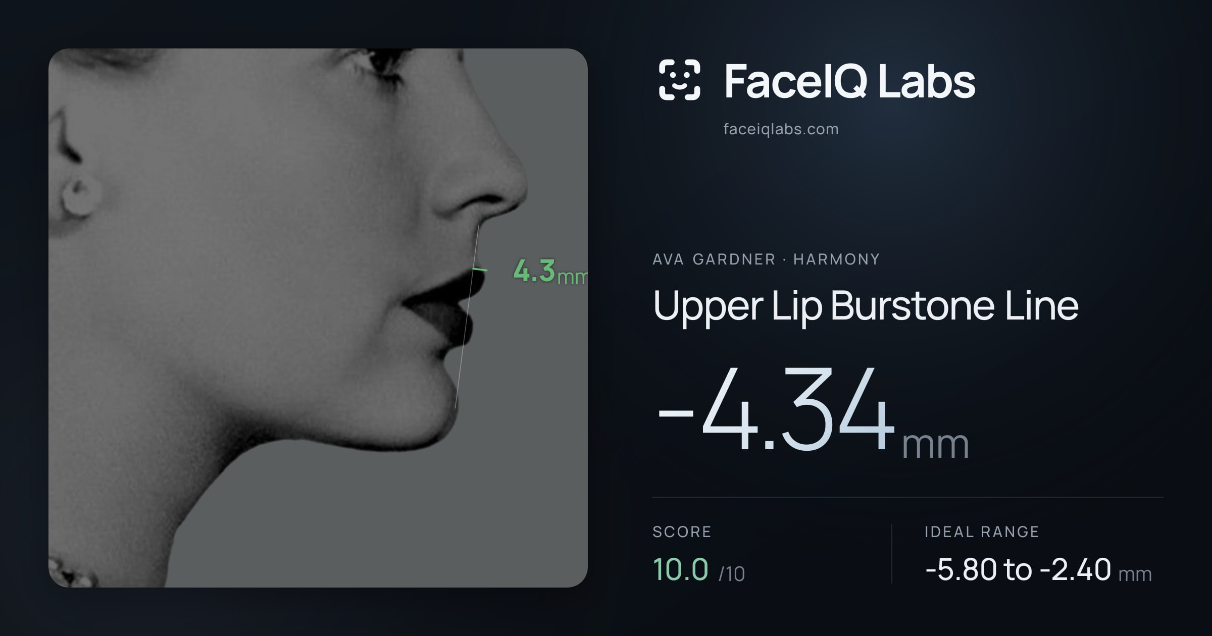 Ava Gardner Upper Lip Burstone Line: -4.34mm, drawn on the photo