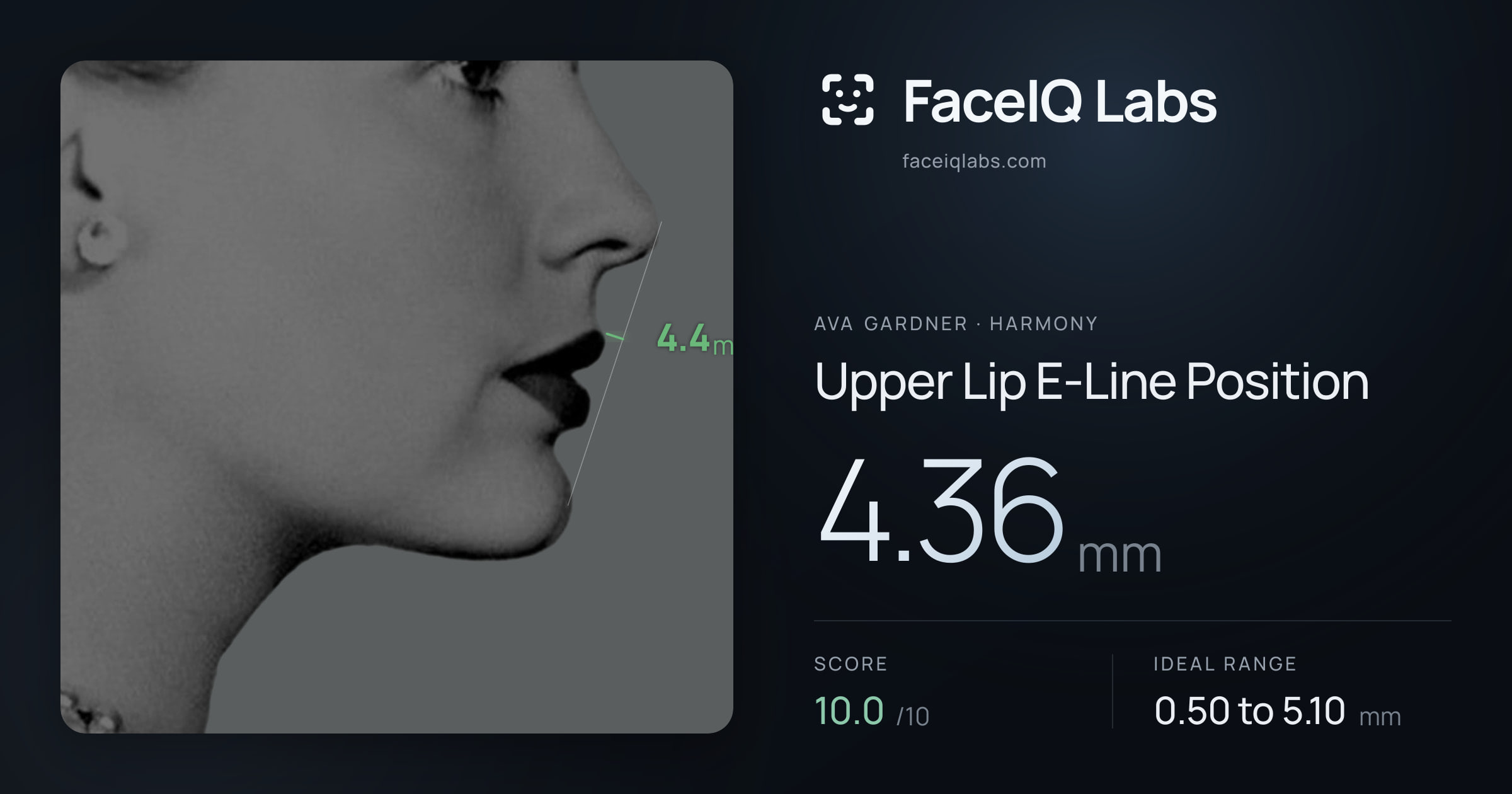 Ava Gardner Upper Lip E-Line Position: 4.36mm, drawn on the photo