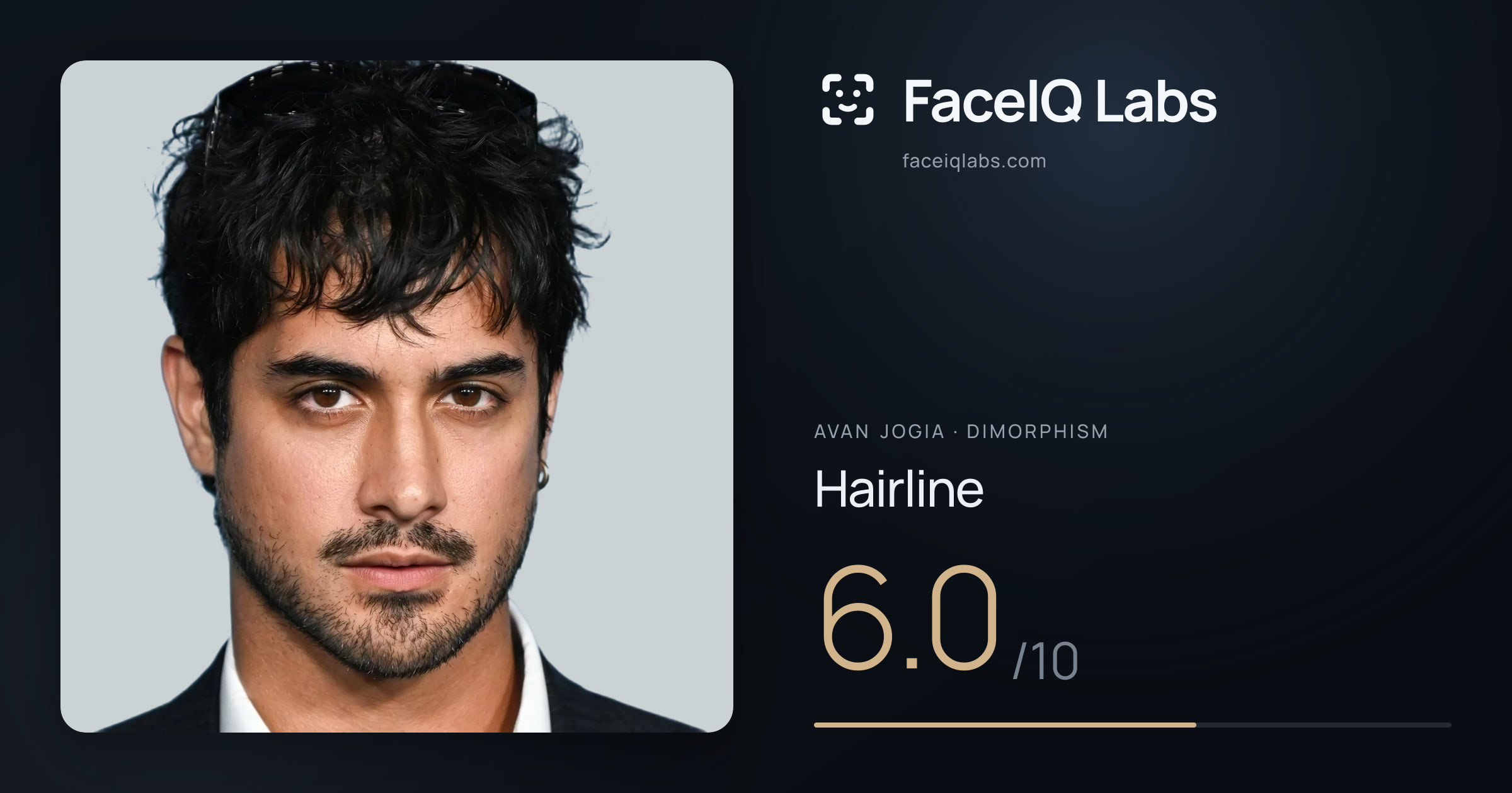 Avan Jogia Hairline: 6.0/10, drawn on the photo