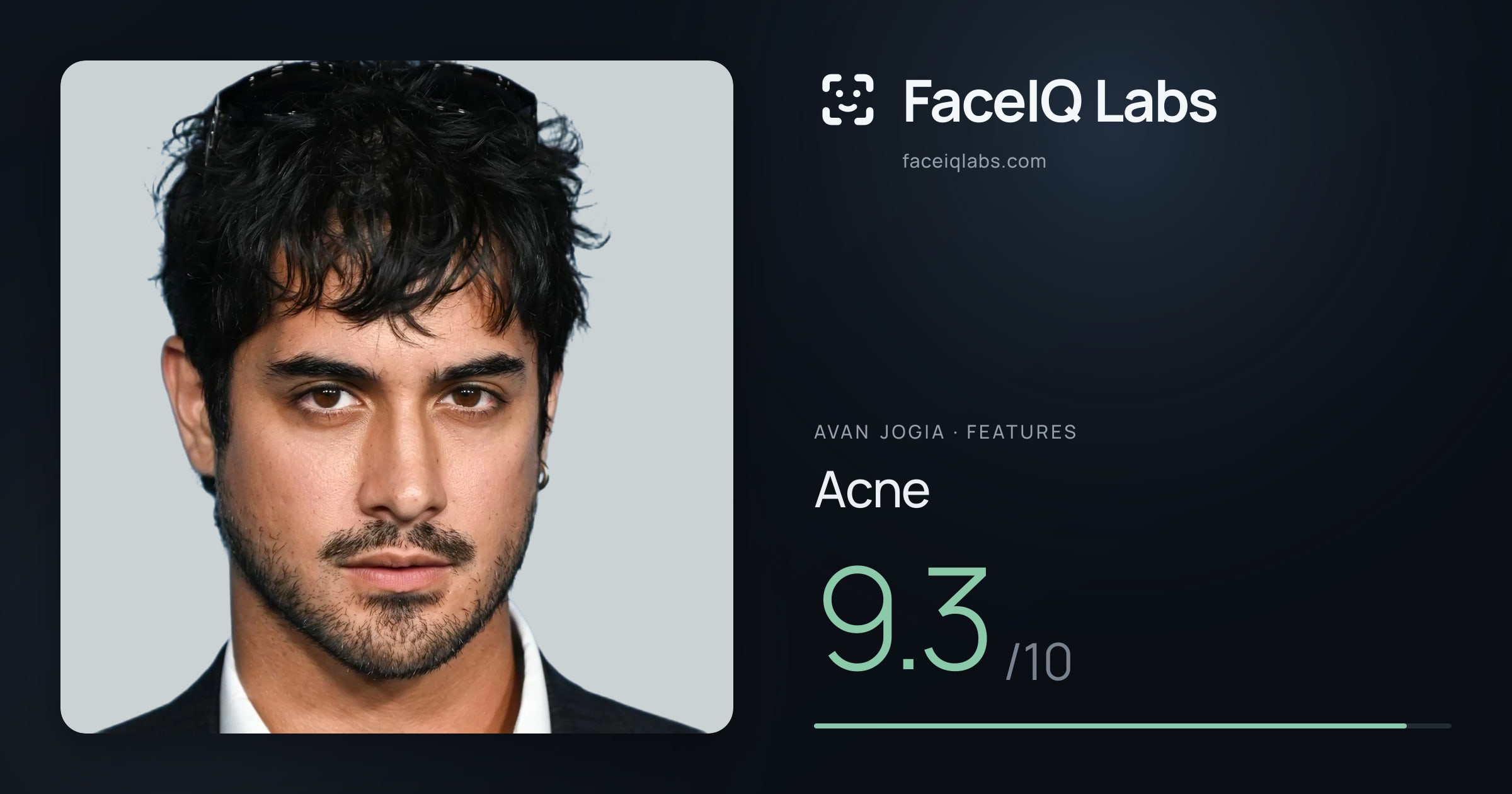 Avan Jogia Acne: 9.3/10, drawn on the photo