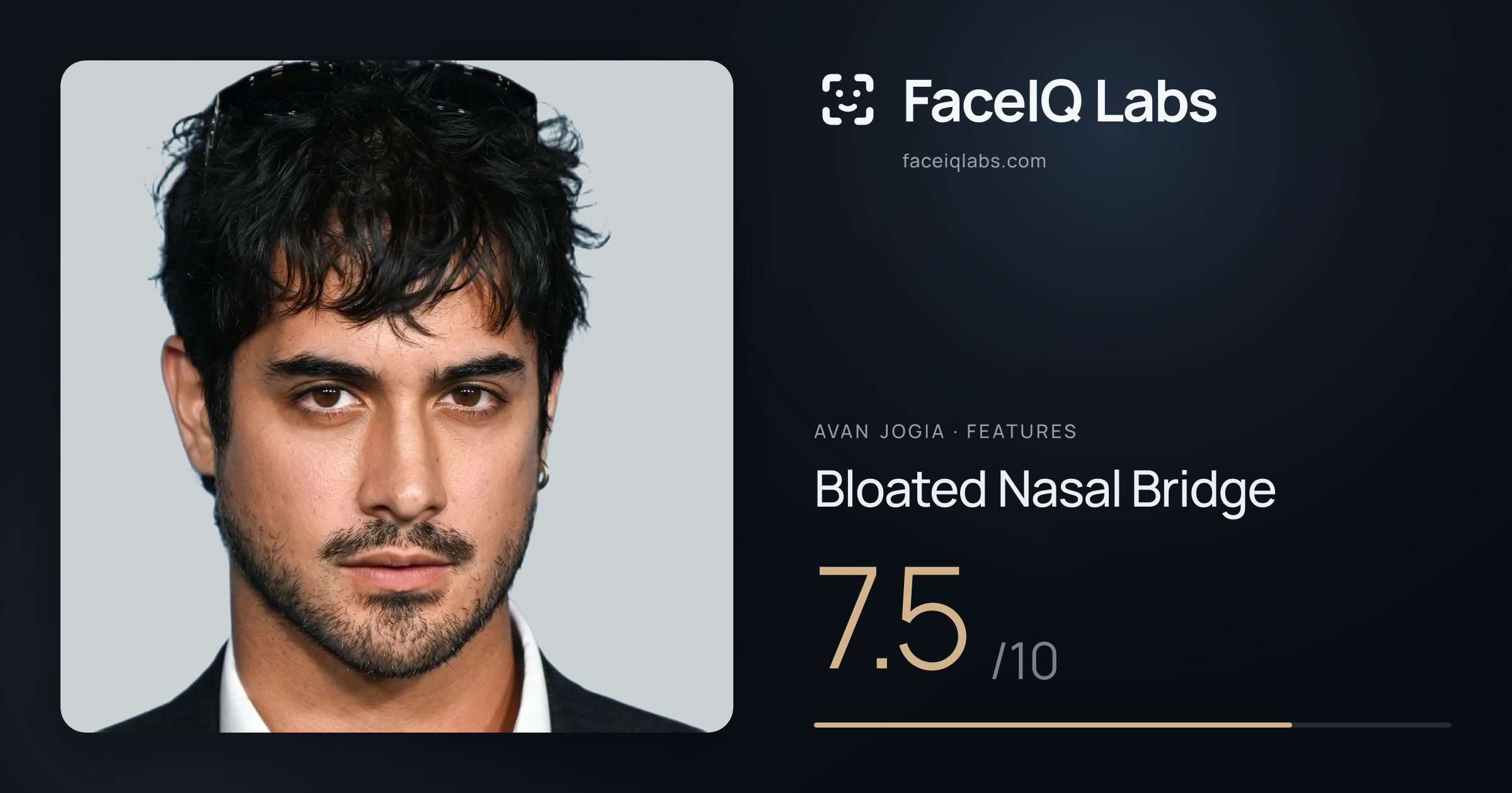 Avan Jogia Bloated Nasal Bridge: 7.5/10, drawn on the photo