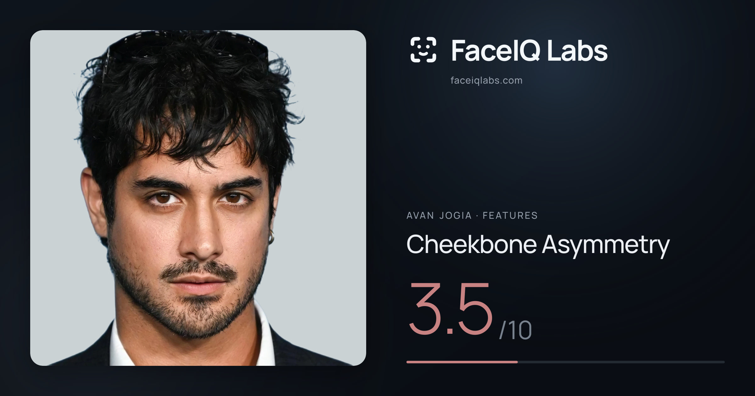 Avan Jogia Cheekbone Asymmetry: 3.5/10, drawn on the photo