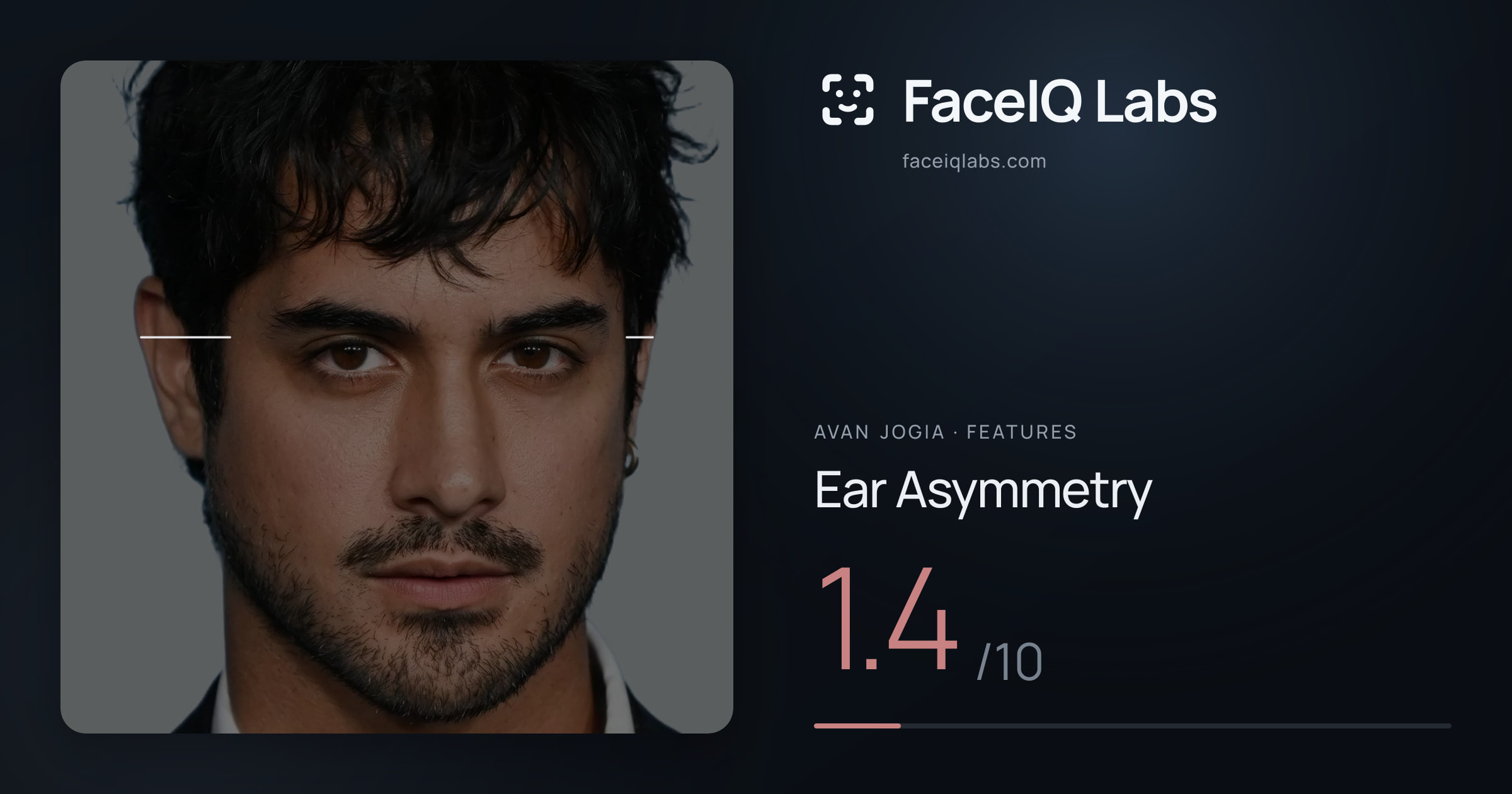 Avan Jogia Ear Asymmetry: 1.4/10, drawn on the photo