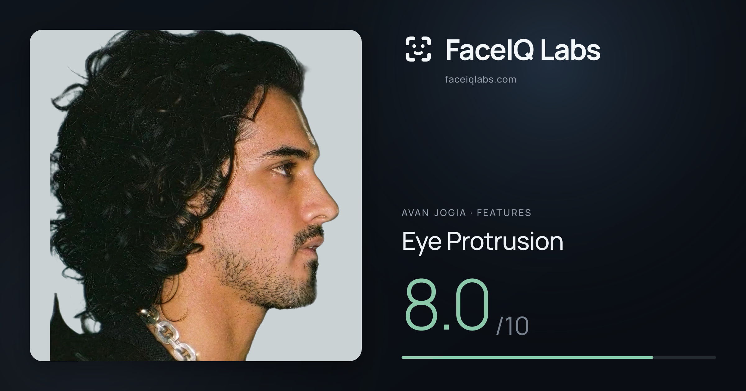 Avan Jogia Eye Protrusion: 8.0/10, drawn on the photo