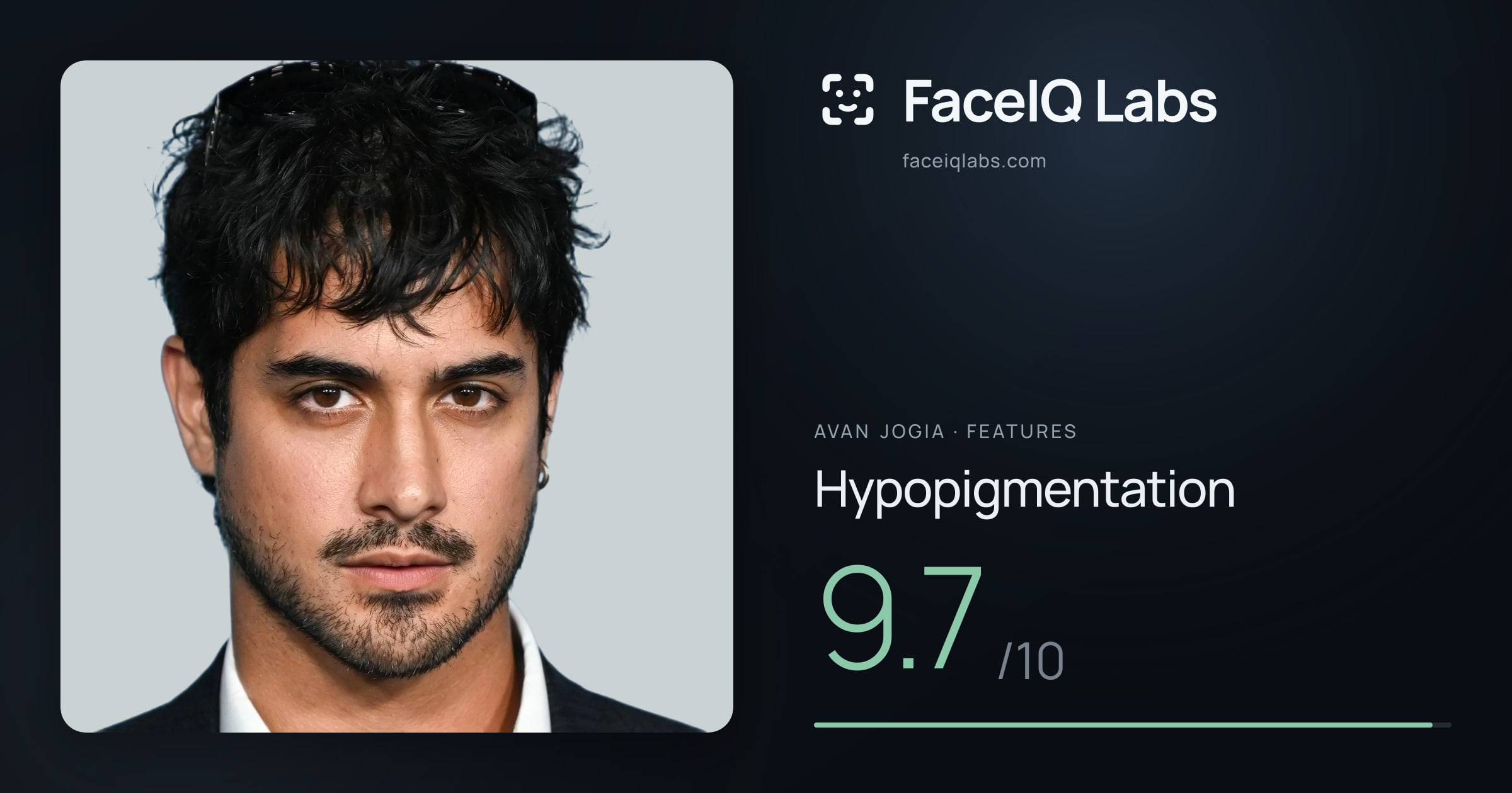 Avan Jogia Hypopigmentation: 9.7/10, drawn on the photo