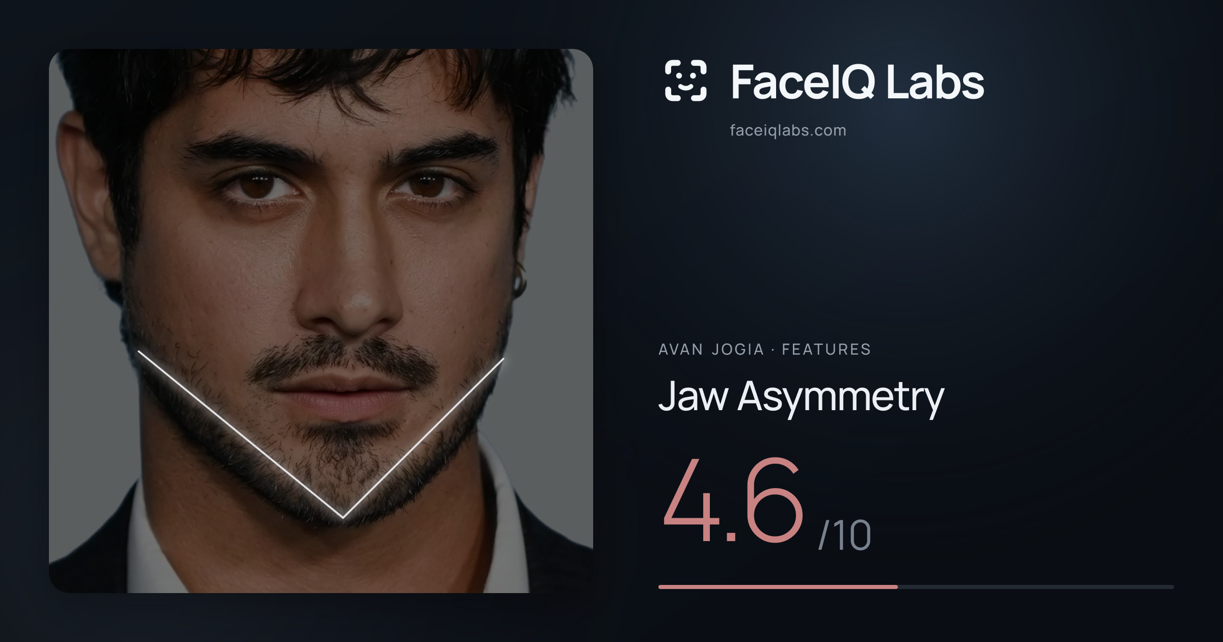 Avan Jogia Jaw Asymmetry: 4.6/10, drawn on the photo