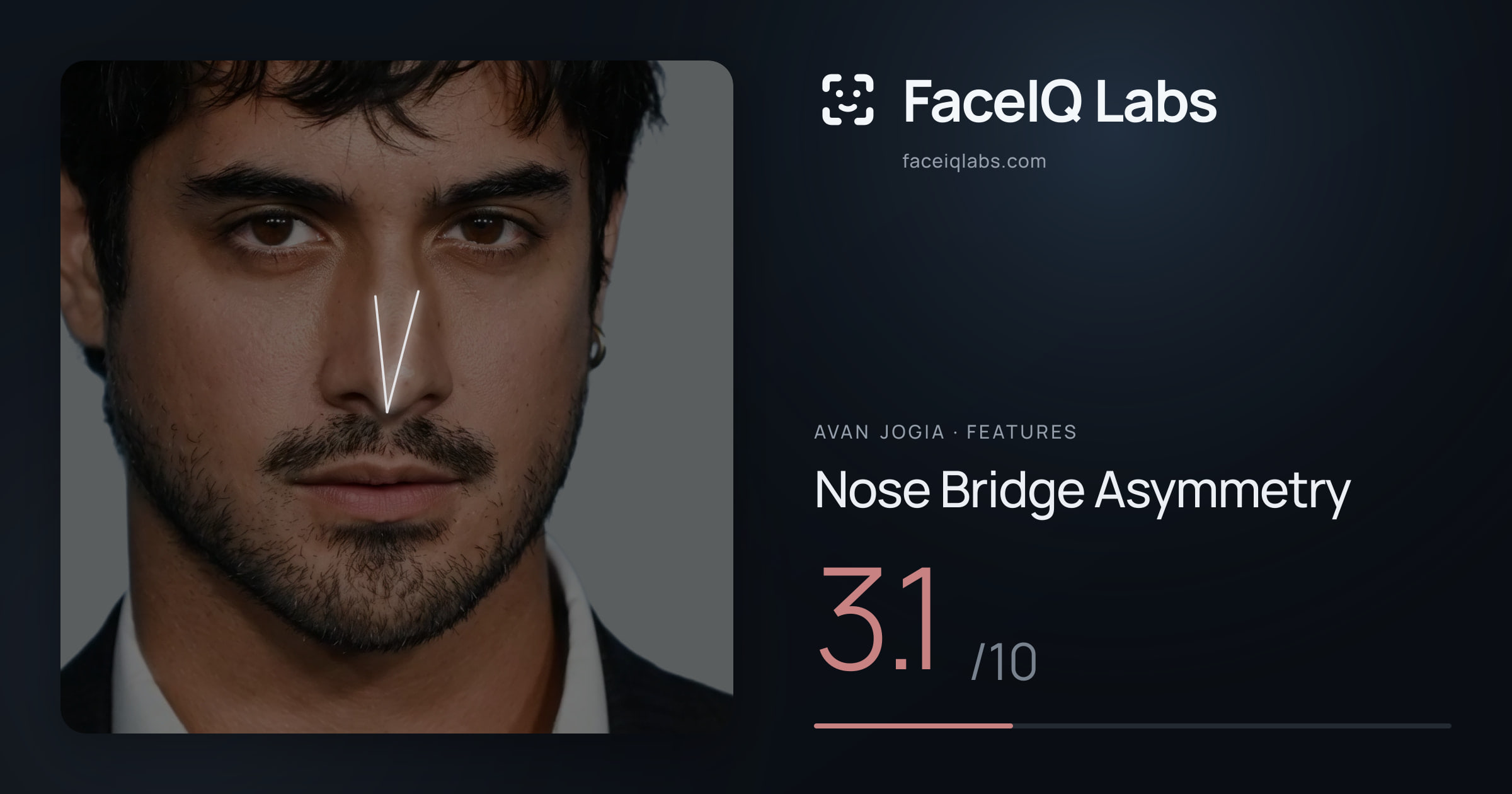 Avan Jogia Nose Bridge Asymmetry: 3.1/10, drawn on the photo