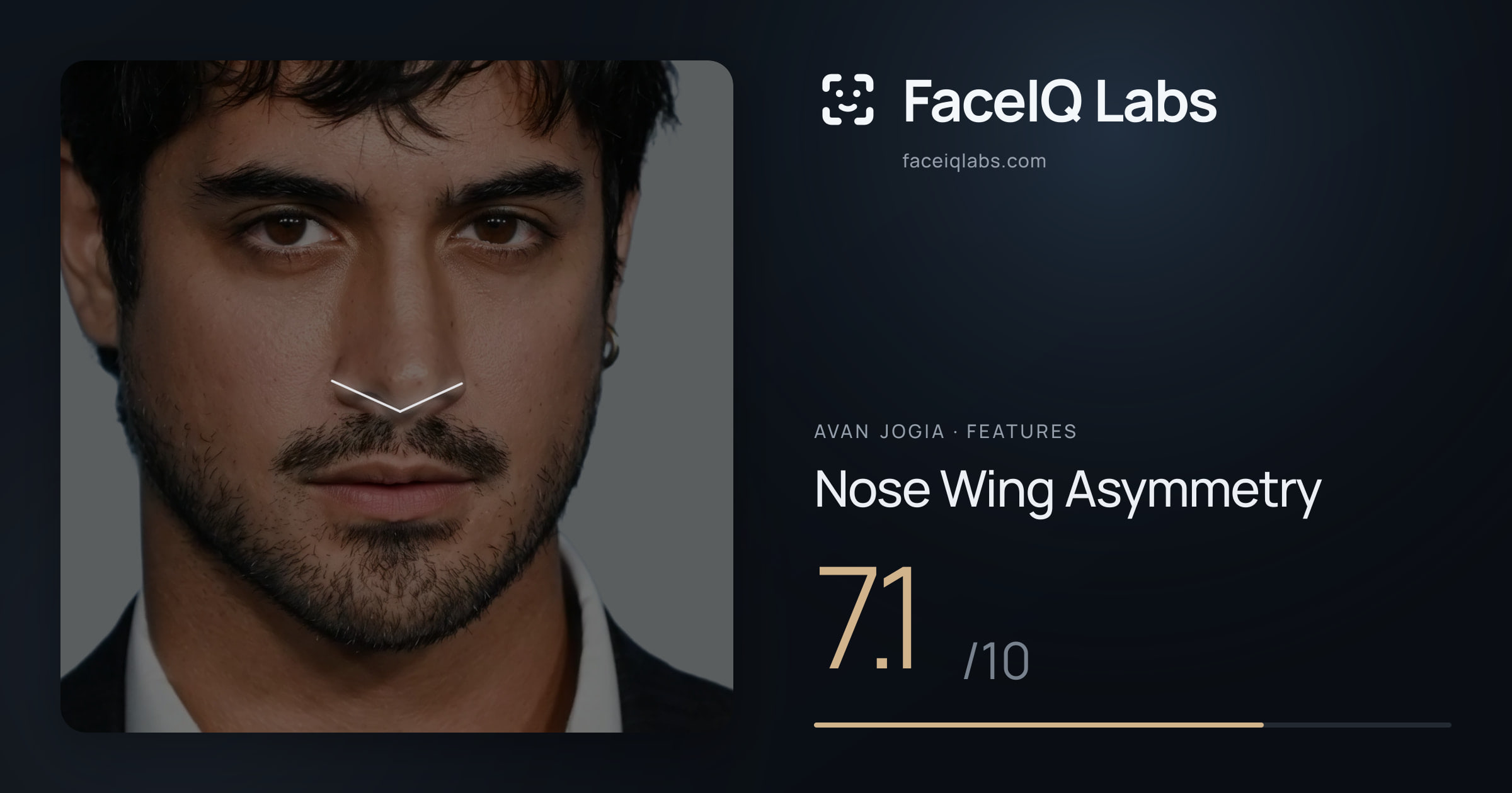 Avan Jogia Nose Wing Asymmetry: 7.1/10, drawn on the photo
