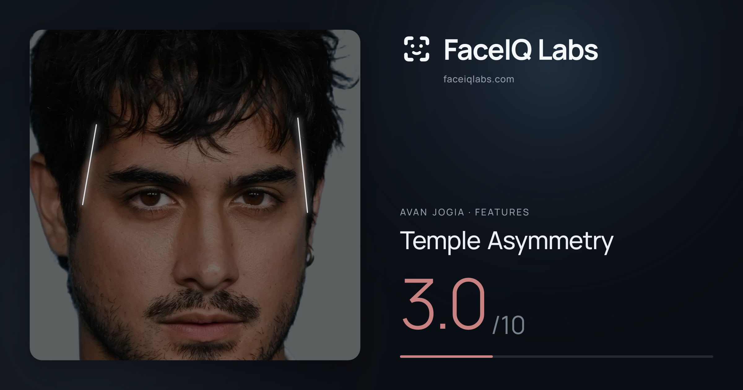 Avan Jogia Temple Asymmetry: 3.0/10, drawn on the photo