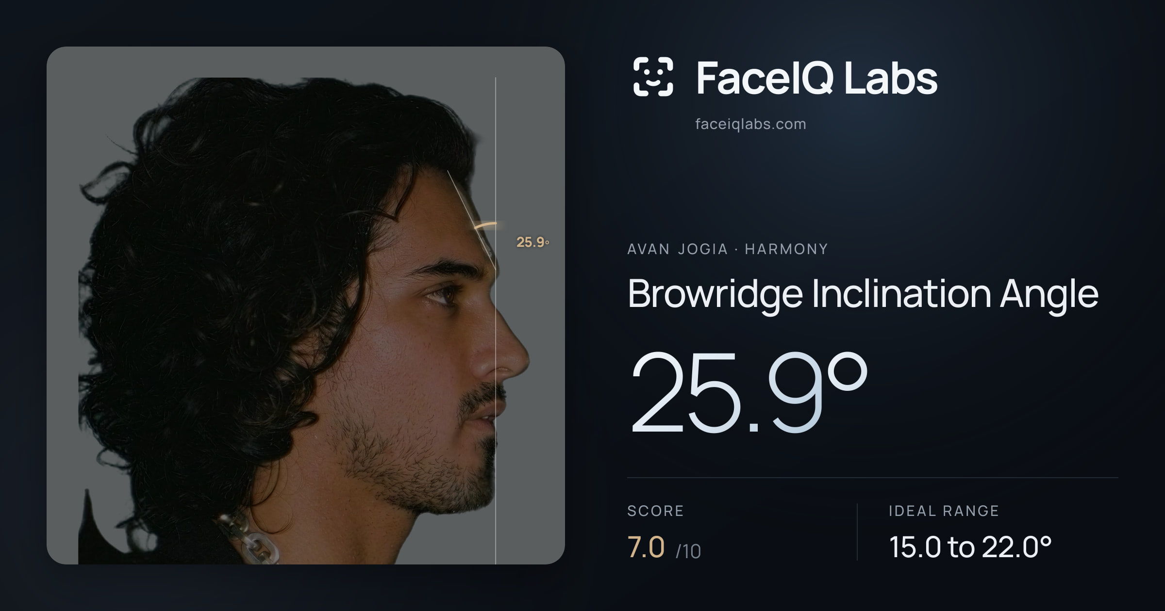 Avan Jogia Browridge Inclination Angle: 25.9°, drawn on the photo