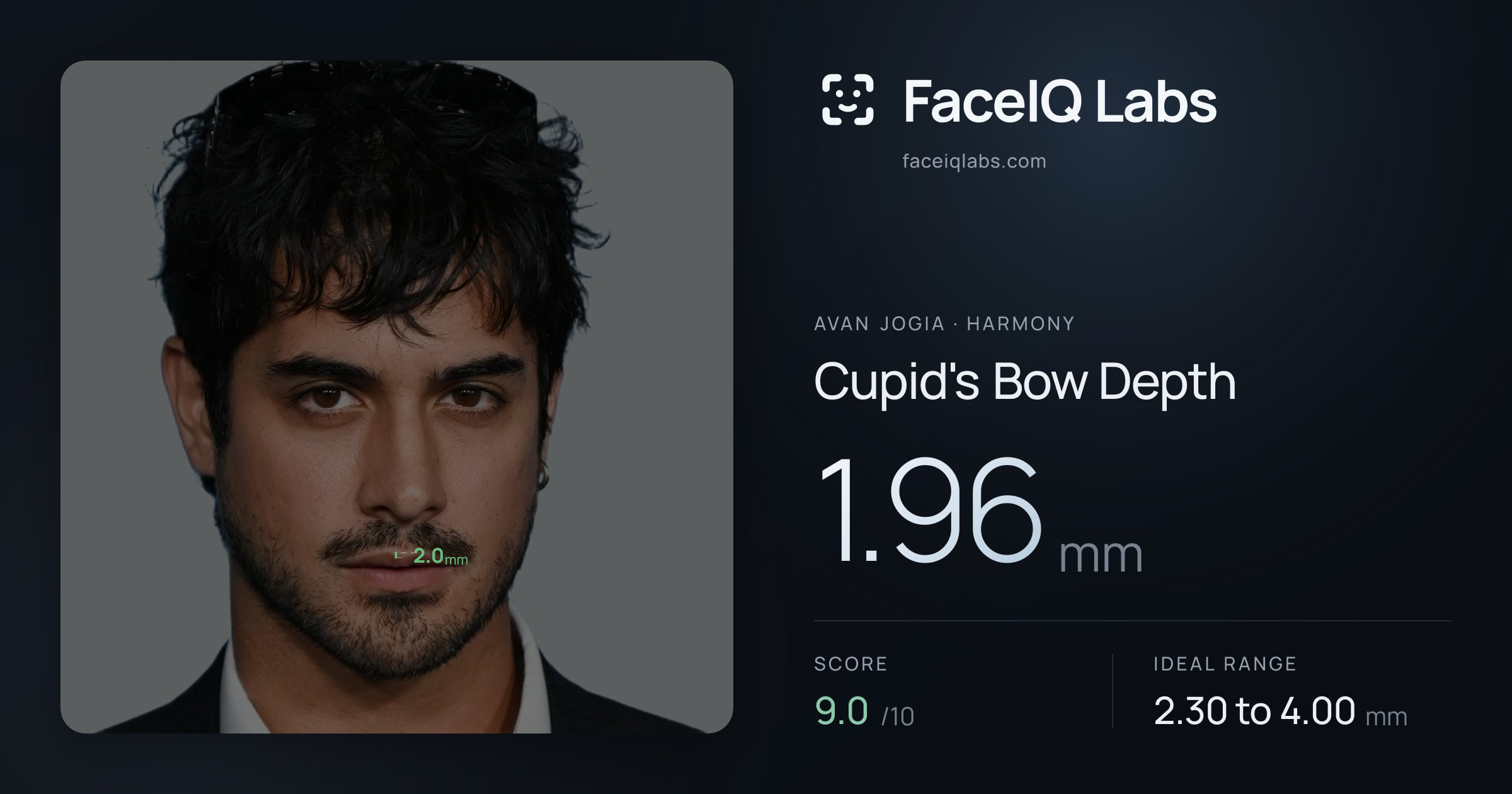 Avan Jogia Cupid's Bow Depth: 1.96mm, drawn on the photo