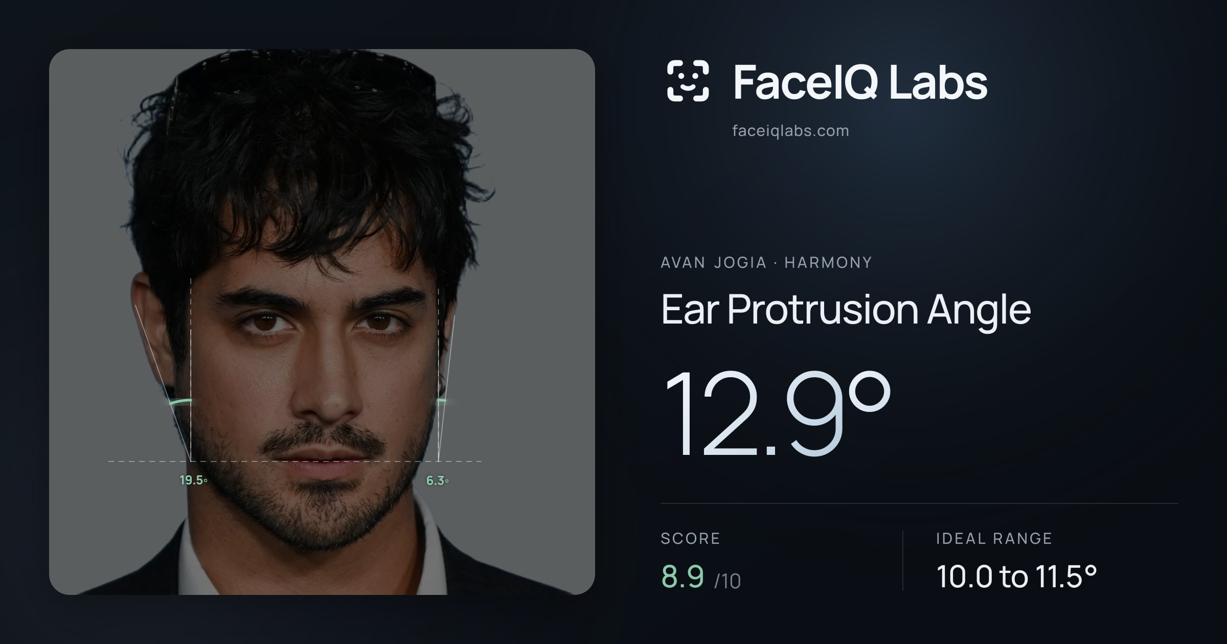 Avan Jogia Ear Protrusion Angle: 12.9°, drawn on the photo