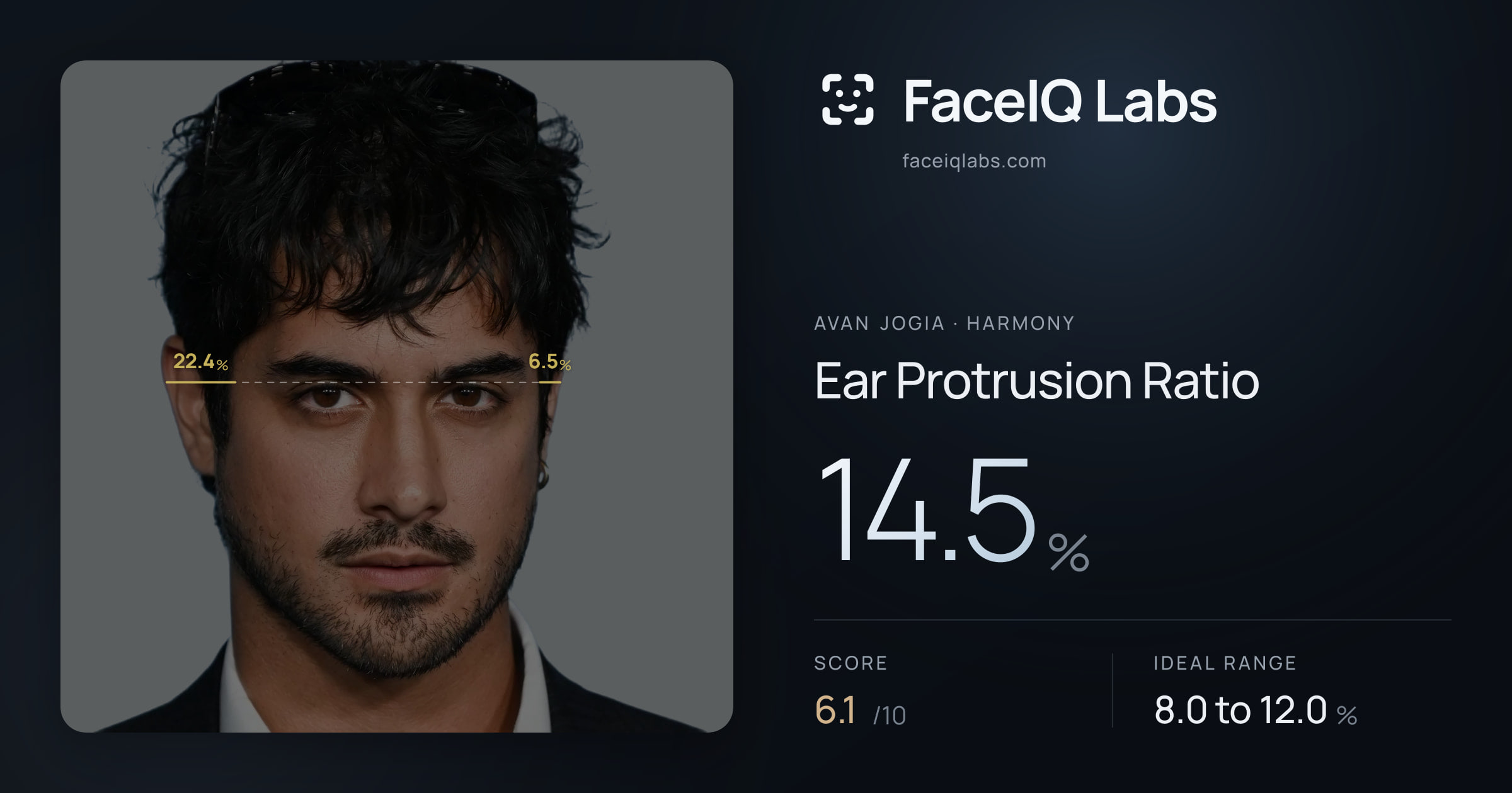 Avan Jogia Ear Protrusion Ratio: 14.5%, drawn on the photo