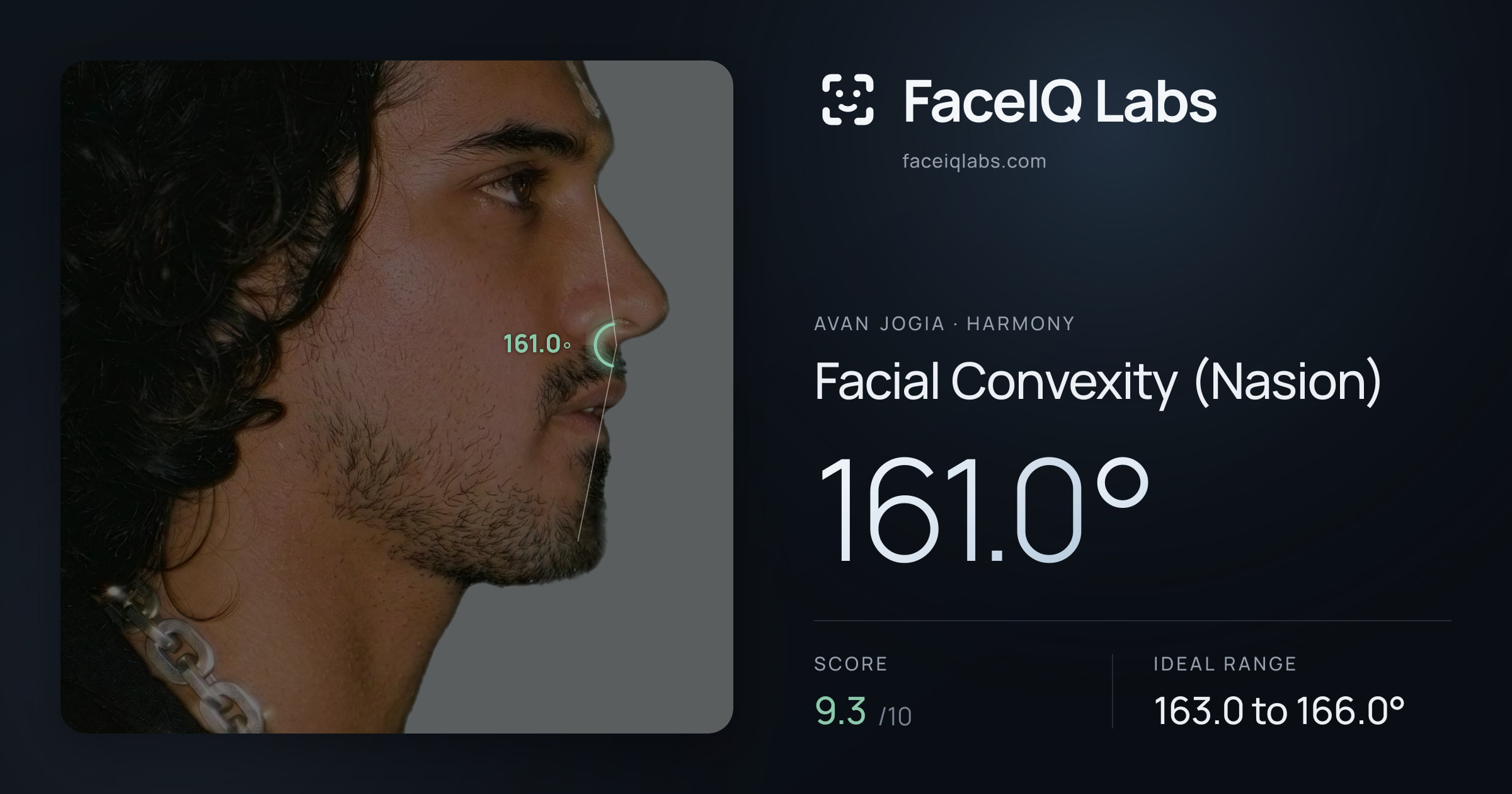 Avan Jogia Facial Convexity (Nasion): 161.0°, drawn on the photo