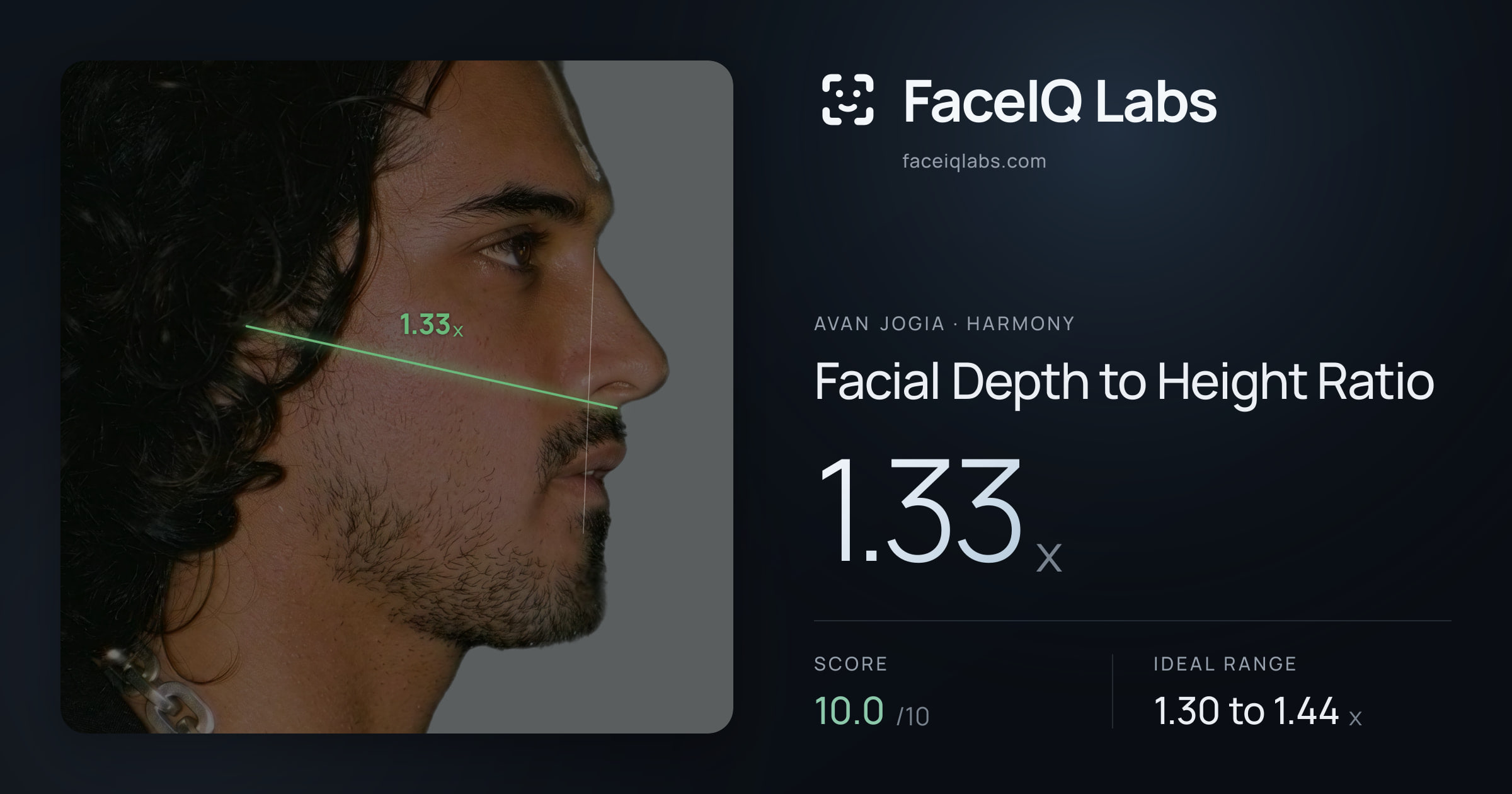 Avan Jogia Facial Depth to Height Ratio: 1.33x, drawn on the photo