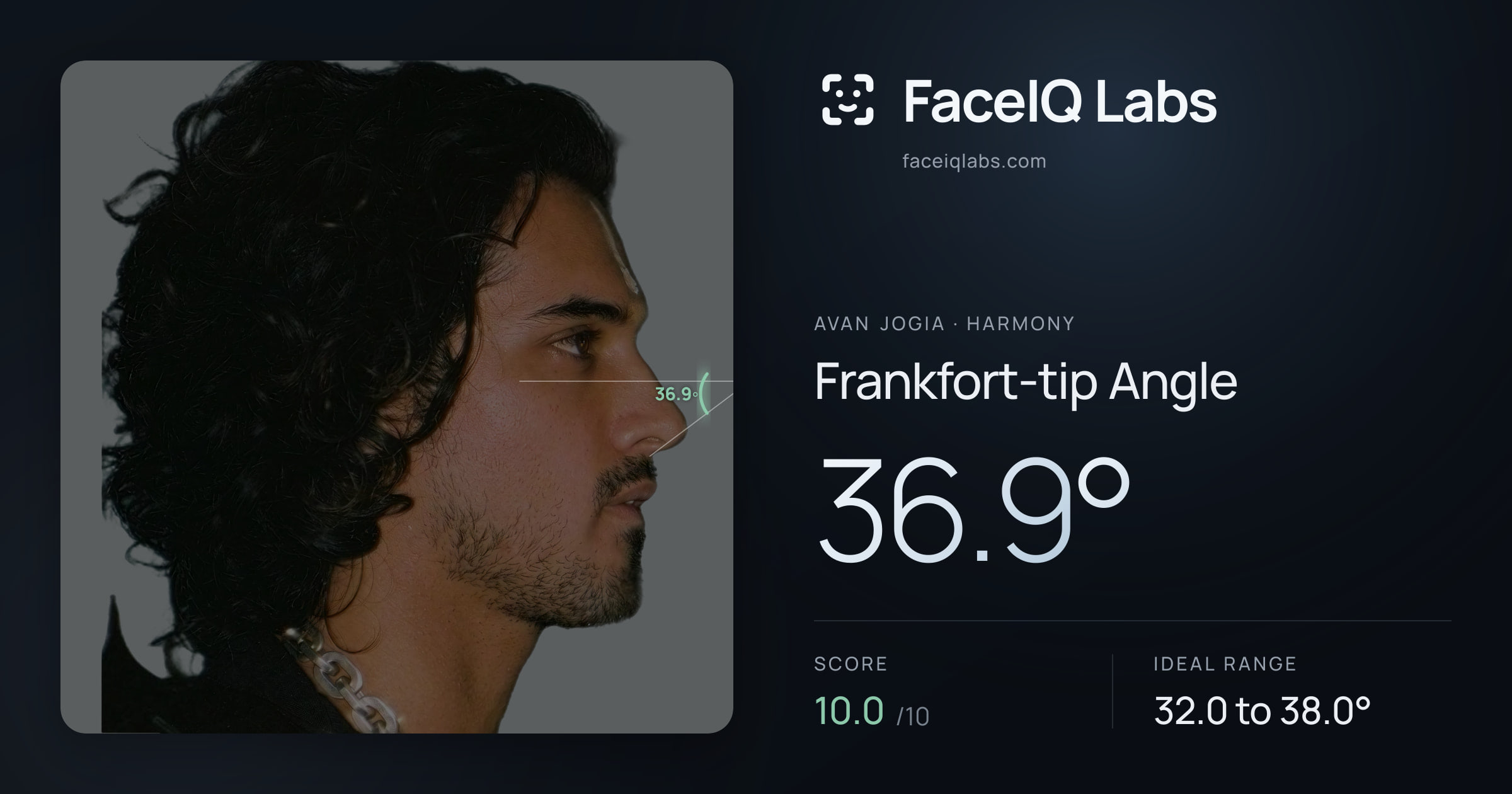 Avan Jogia Frankfort-tip Angle: 36.9°, drawn on the photo