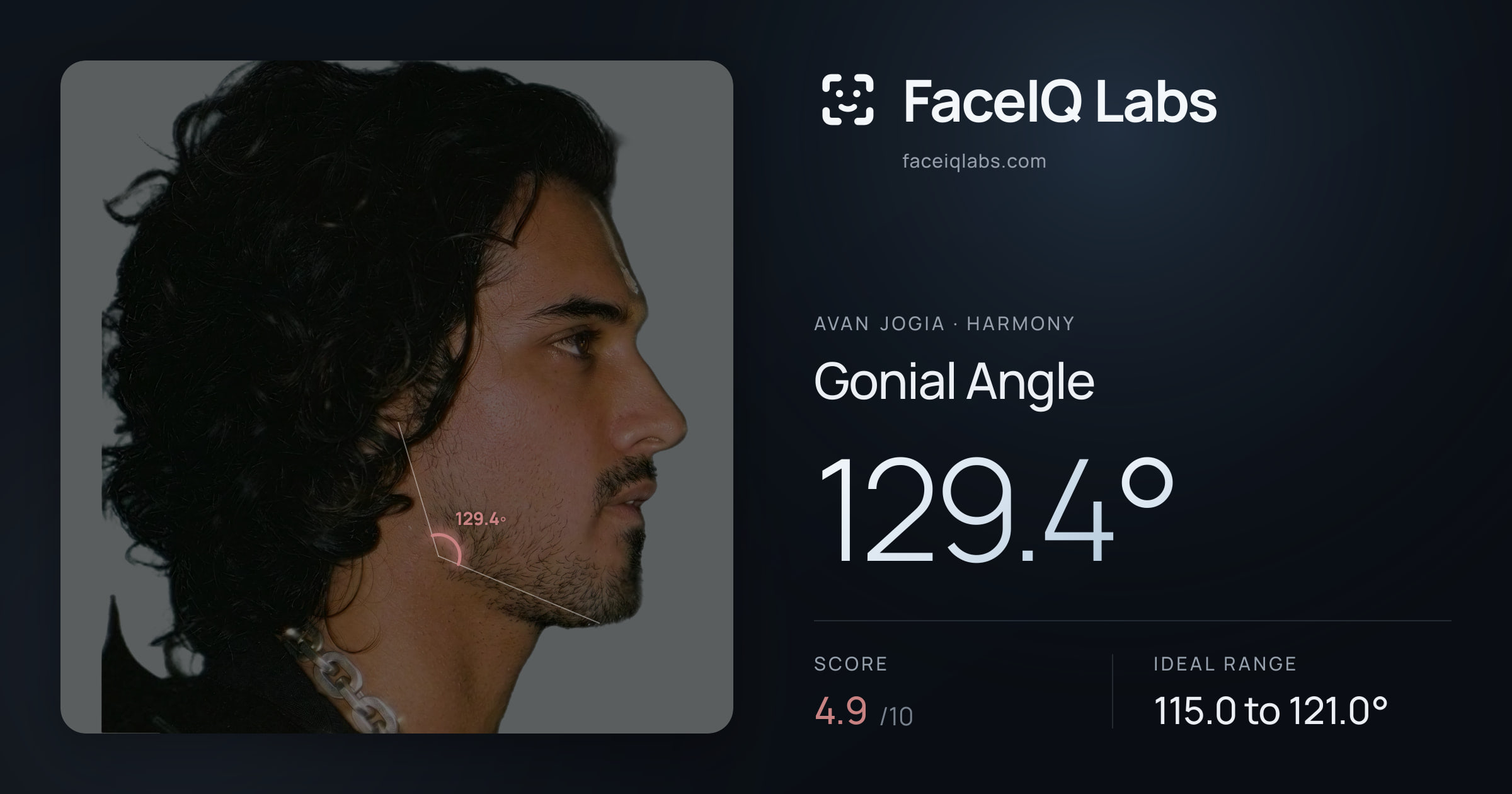 Avan Jogia Gonial Angle: 129.4°, drawn on the photo