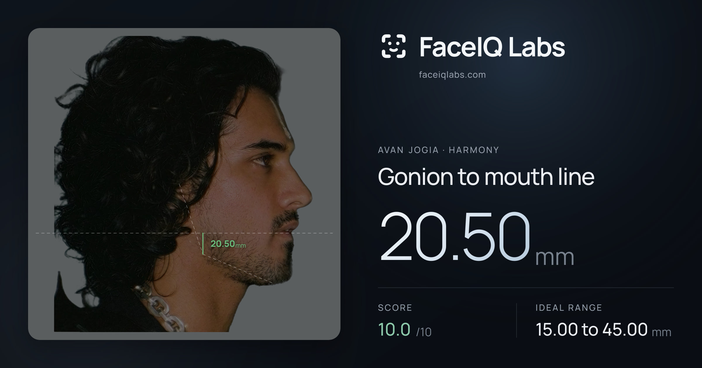 Avan Jogia Gonion to mouth line: 20.50mm, drawn on the photo