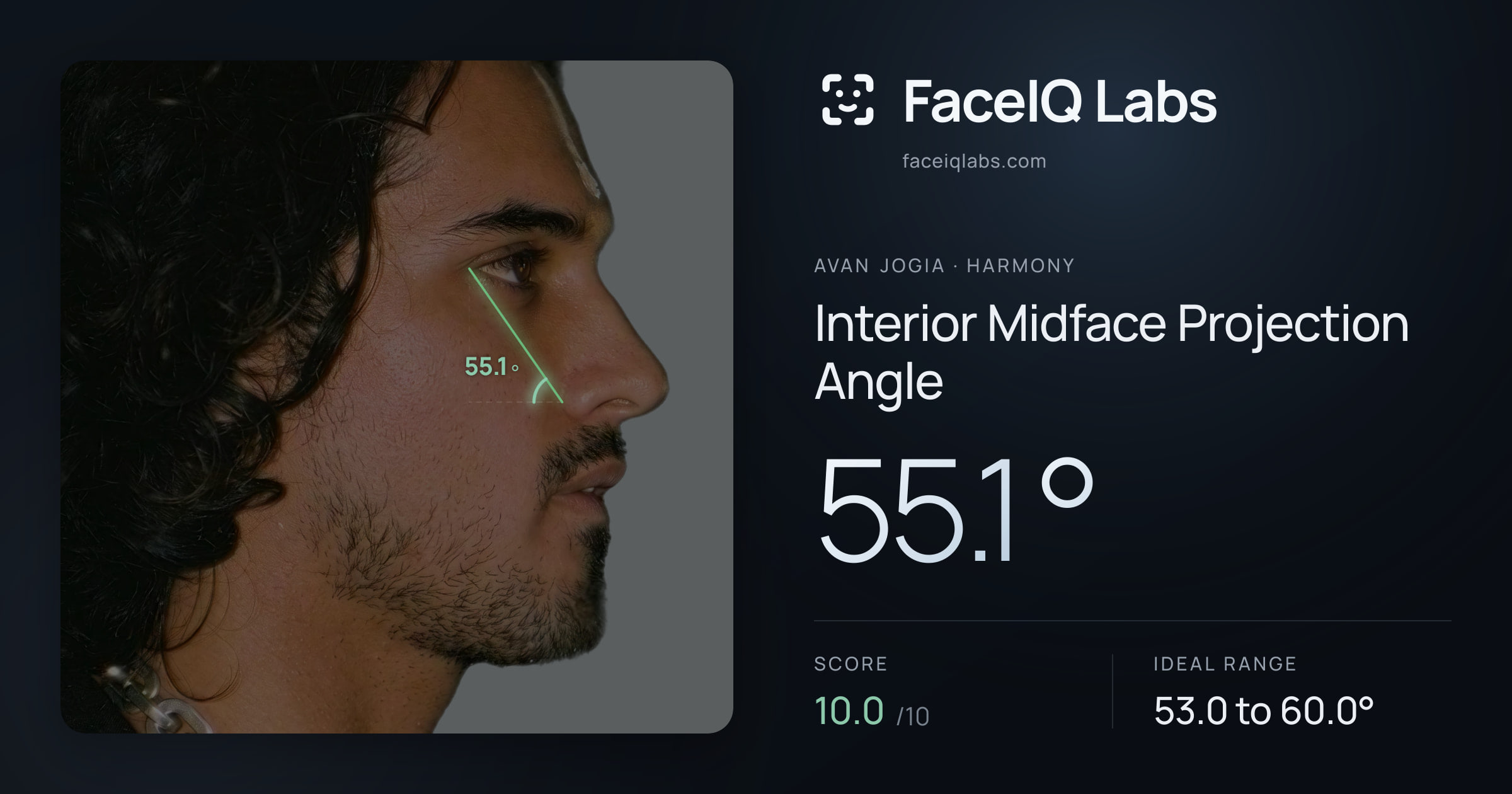 Avan Jogia Interior Midface Projection Angle: 55.1°, drawn on the photo