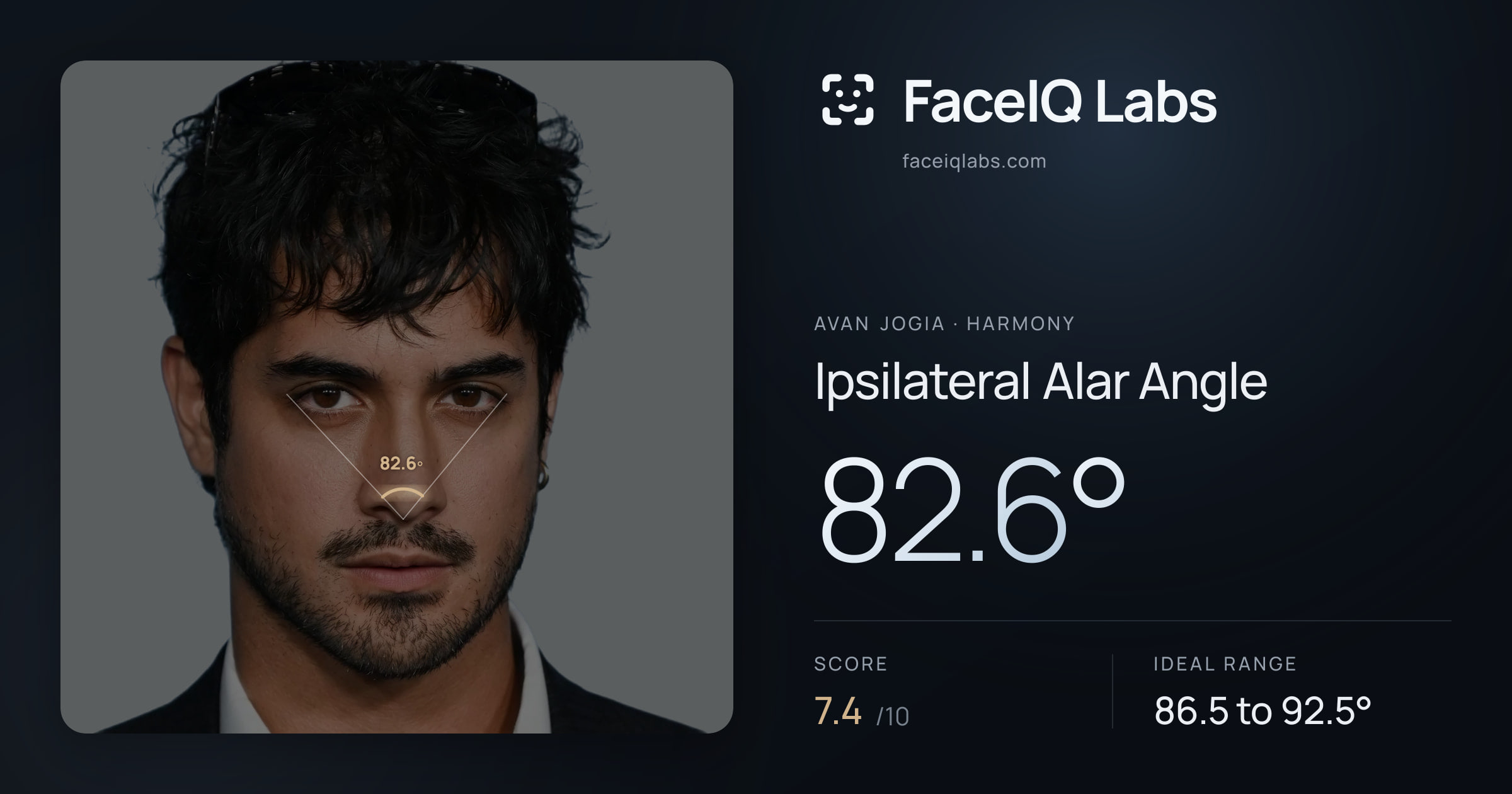 Avan Jogia Ipsilateral Alar Angle: 82.6°, drawn on the photo