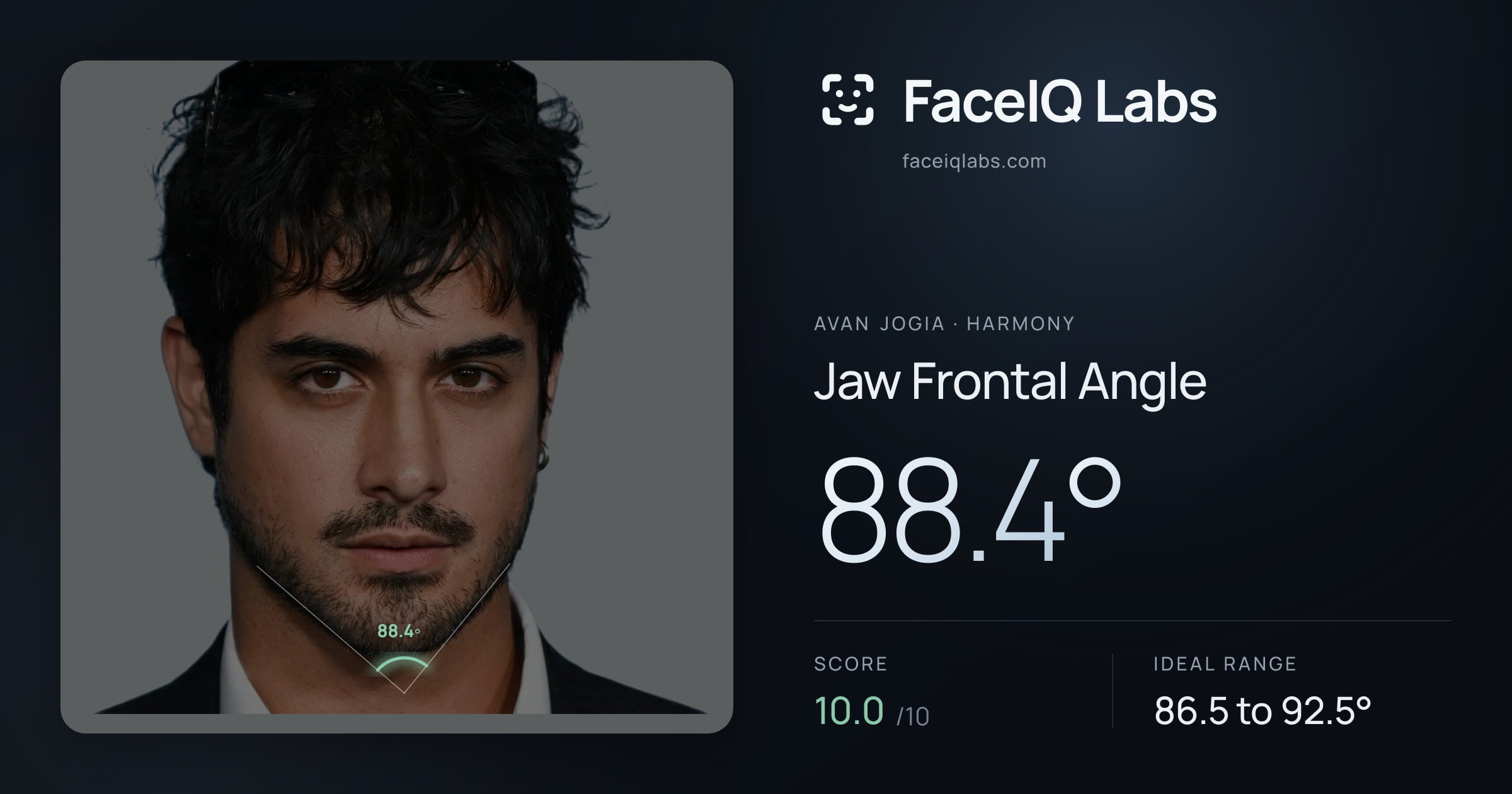Avan Jogia Jaw Frontal Angle: 88.4°, drawn on the photo
