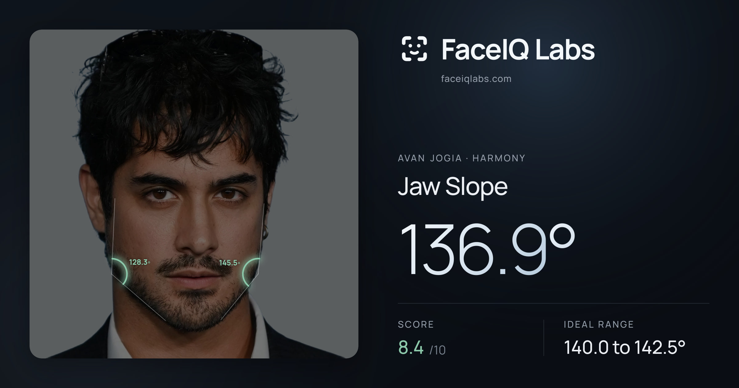 Avan Jogia Jaw Slope: 136.9°, drawn on the photo