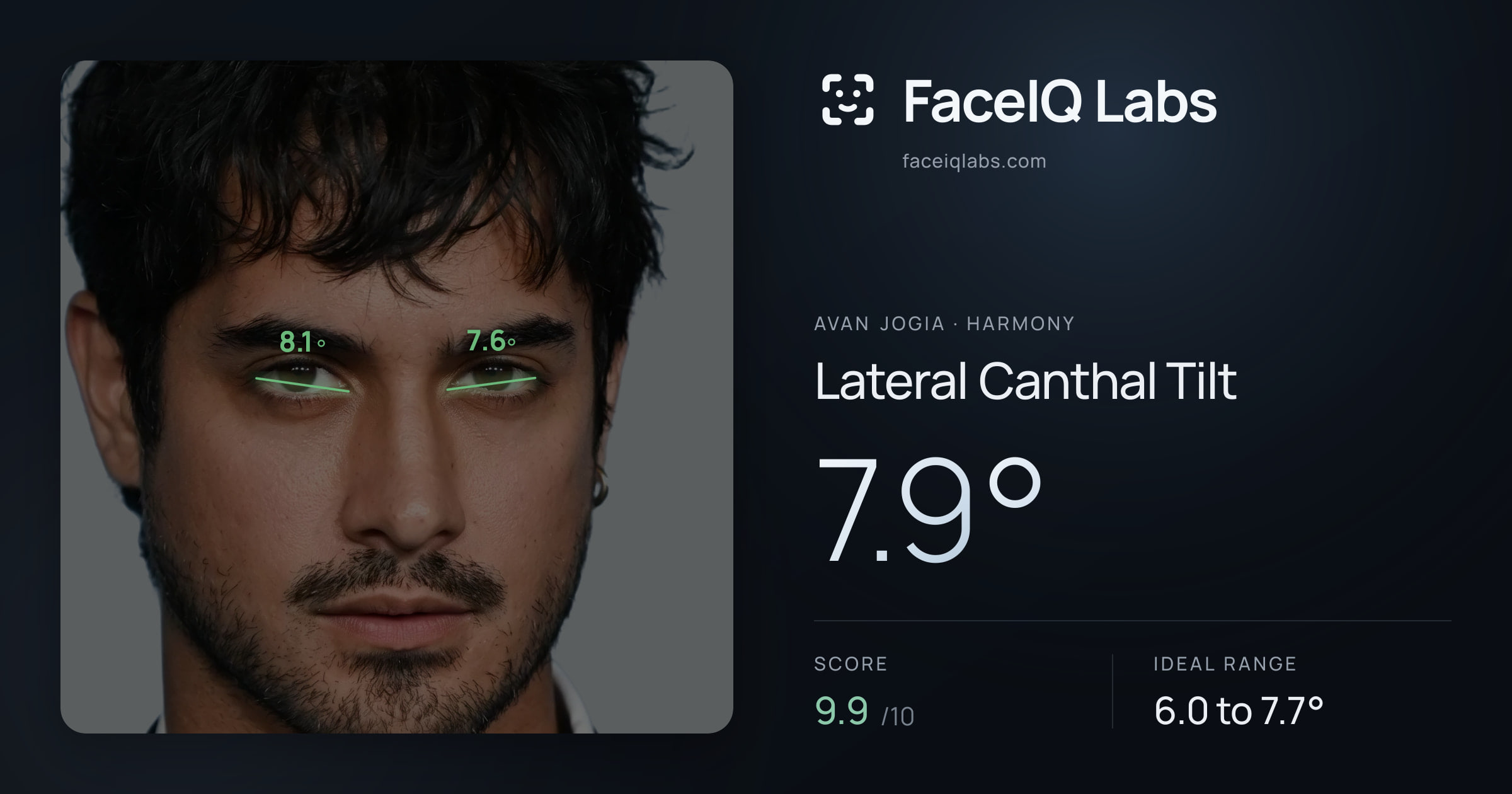 Avan Jogia Lateral Canthal Tilt: 7.9°, drawn on the photo