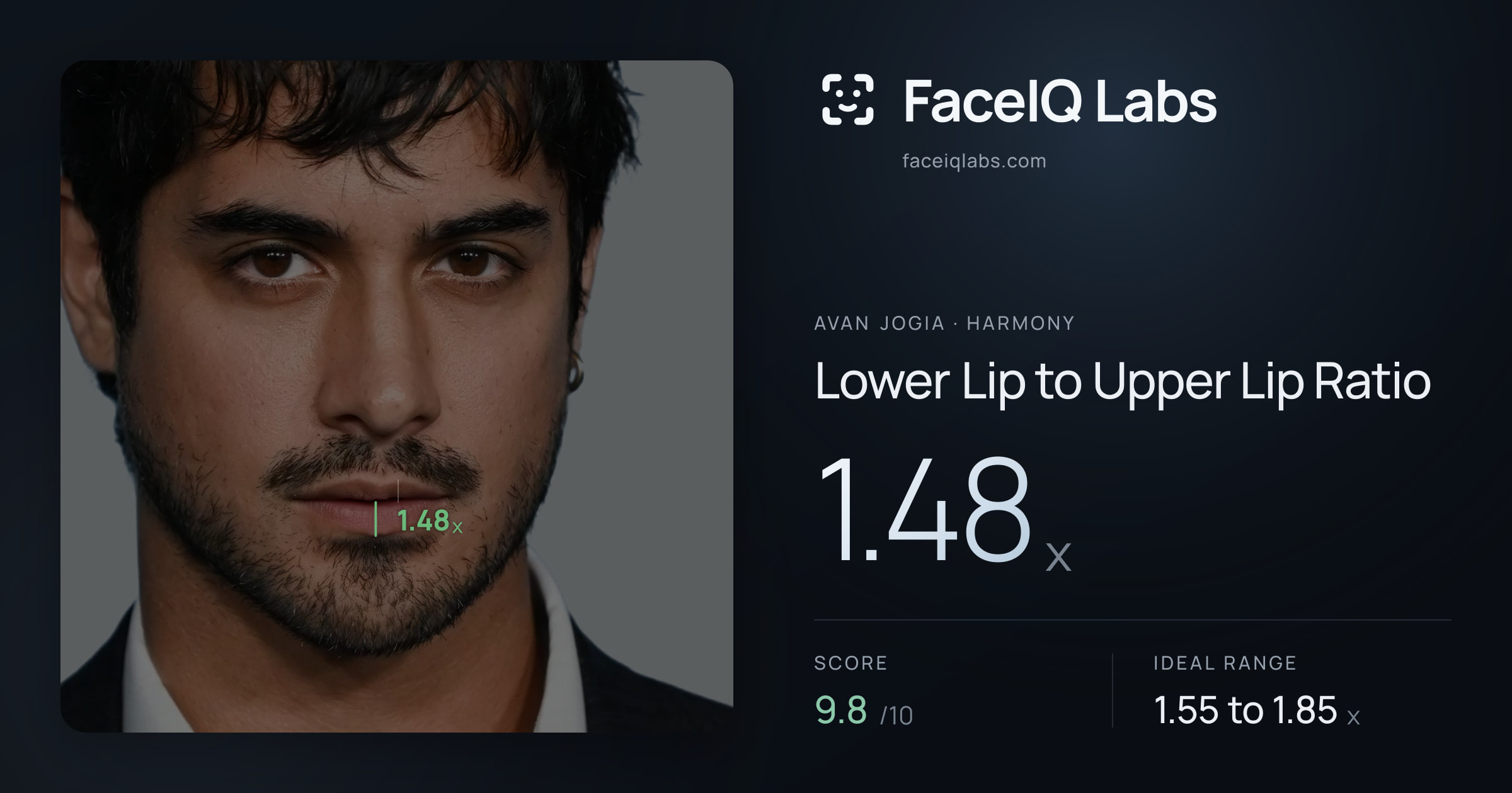 Avan Jogia Lower Lip to Upper Lip Ratio: 1.48x, drawn on the photo