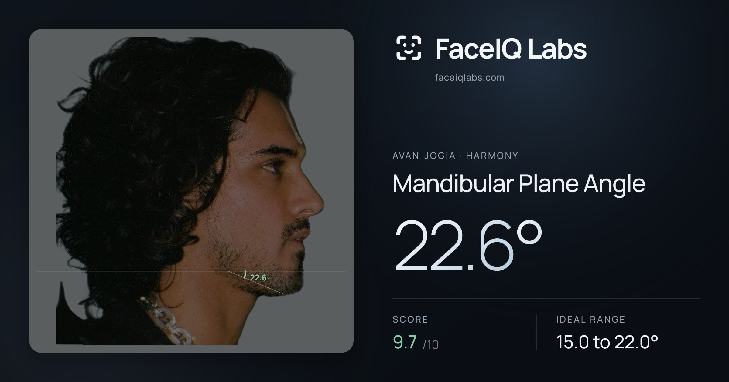 Avan Jogia Mandibular Plane Angle: 22.6°, drawn on the photo