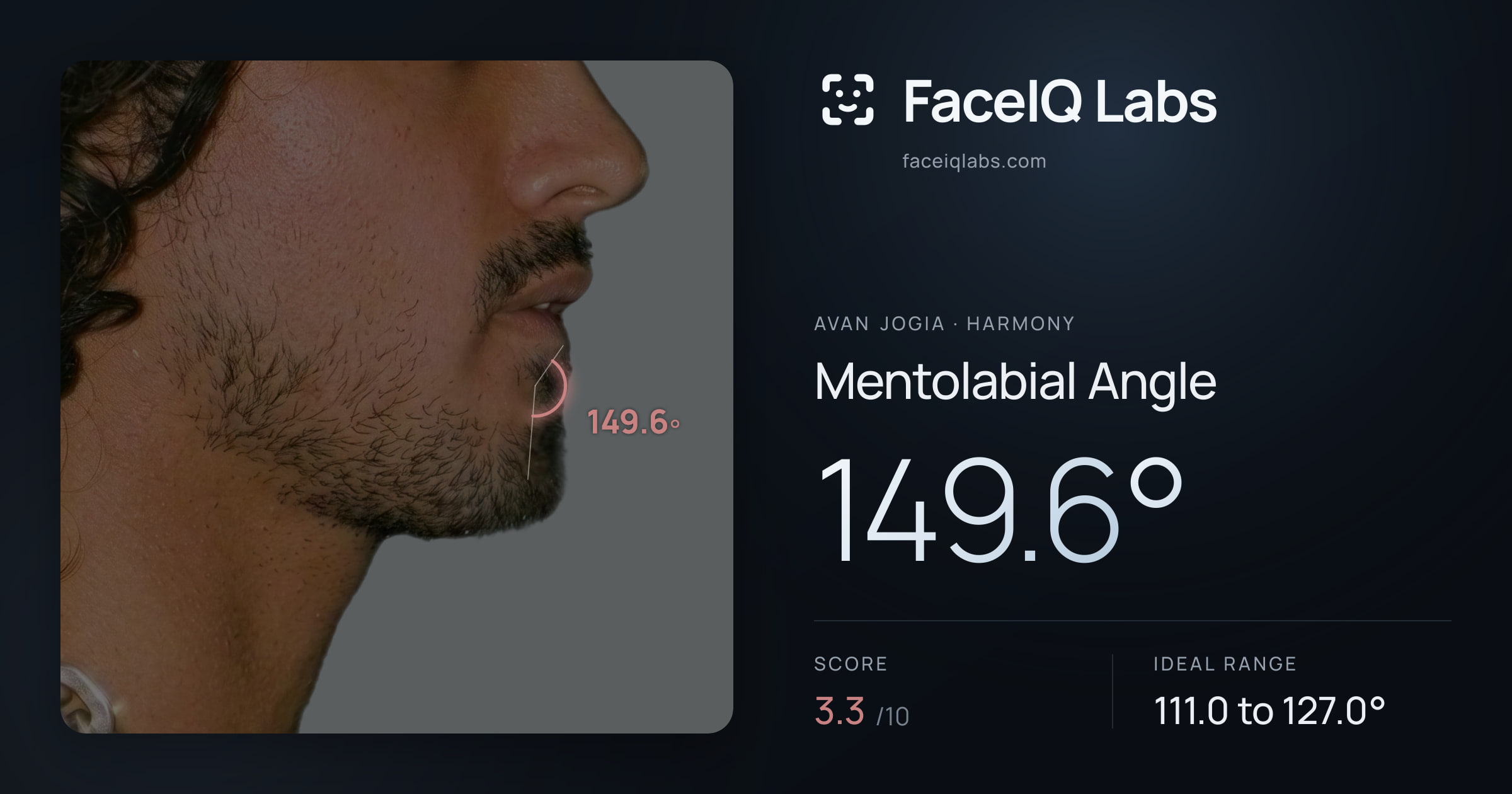 Avan Jogia Mentolabial Angle: 149.6°, drawn on the photo